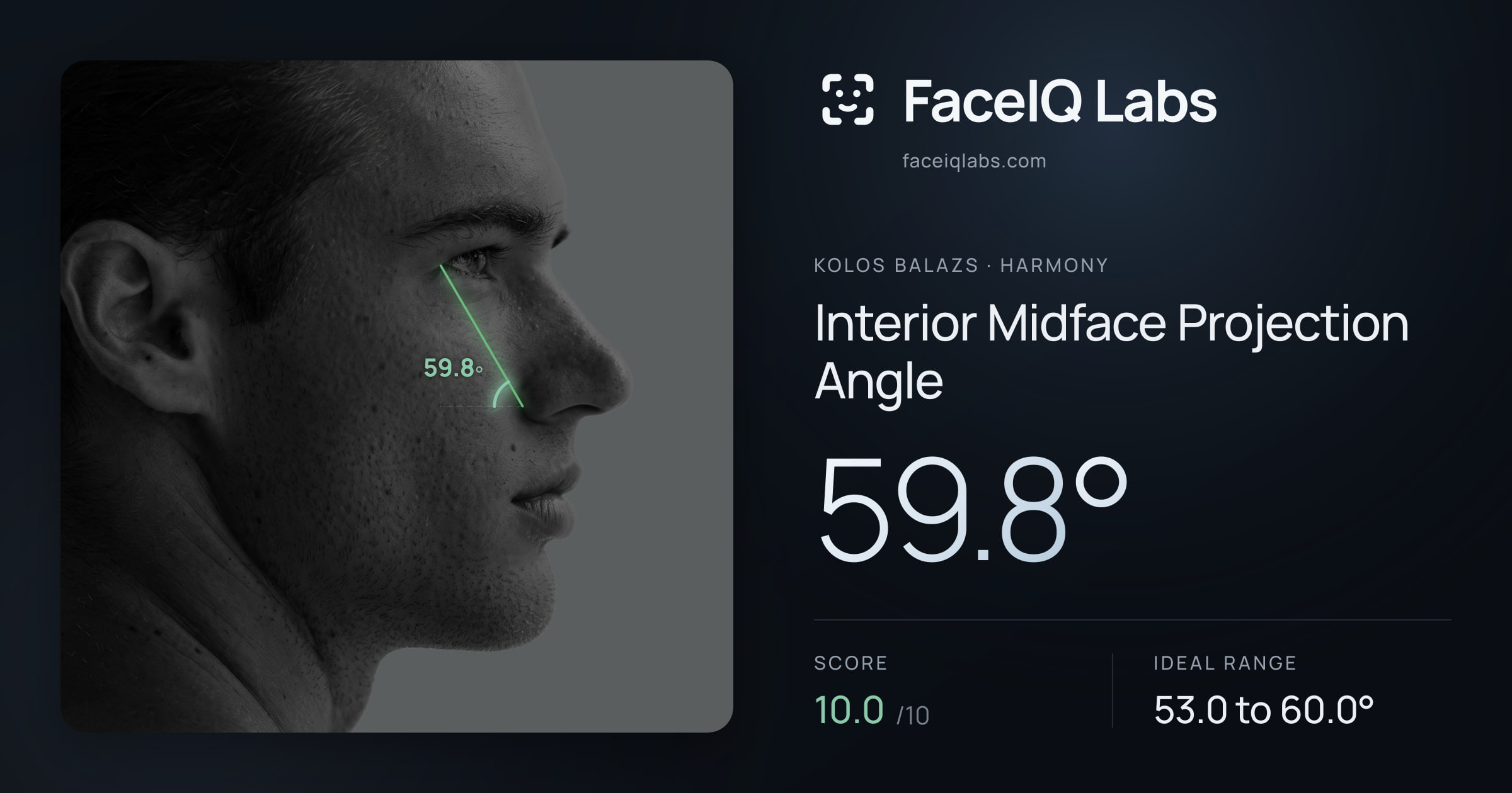 Kolos Balazs Interior Midface Projection Angle: 59.8°, drawn on the photo