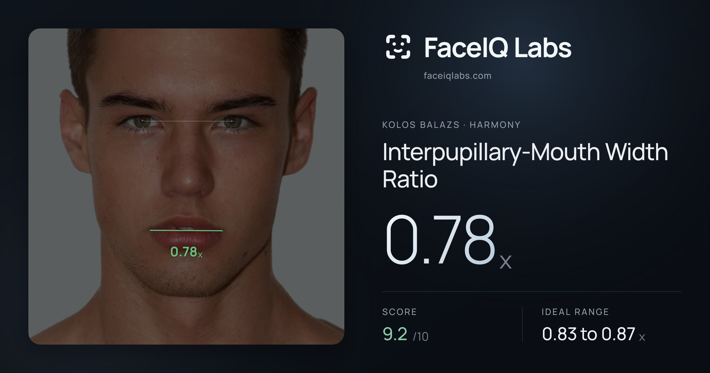 Kolos Balazs Interpupillary-Mouth Width Ratio: 0.78x, drawn on the photo