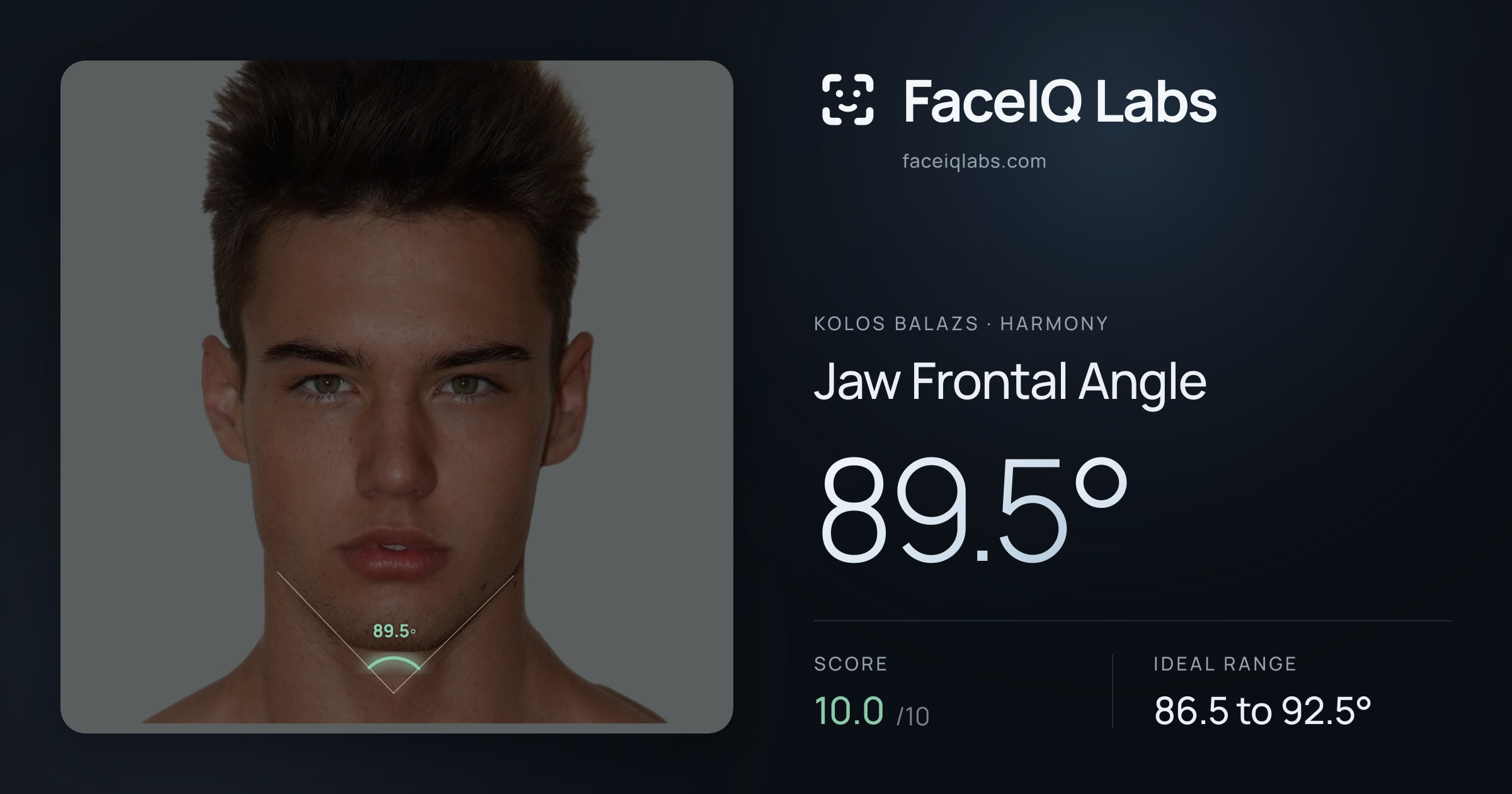 Kolos Balazs Jaw Frontal Angle: 89.5°, drawn on the photo