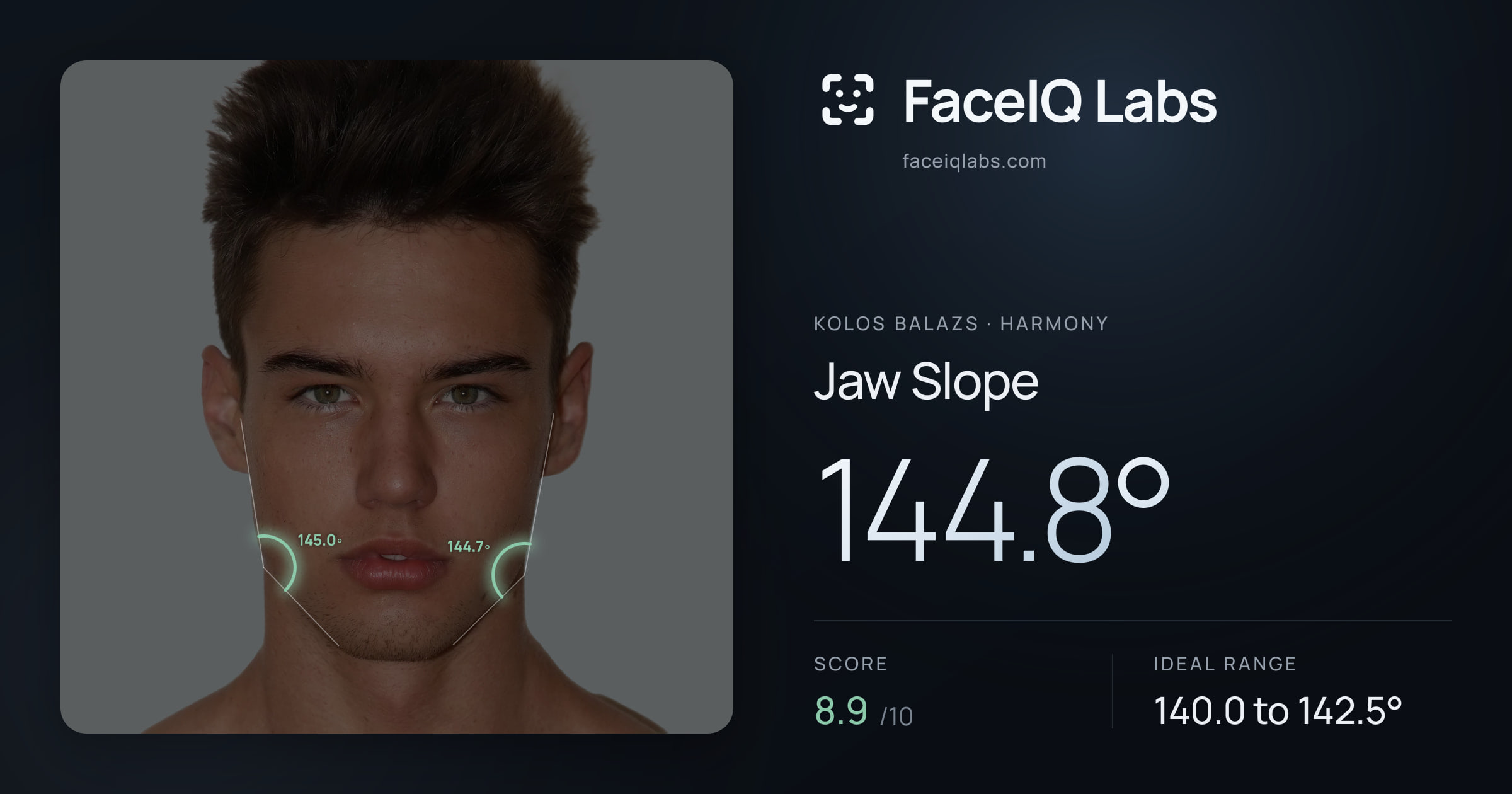 Kolos Balazs Jaw Slope: 144.8°, drawn on the photo