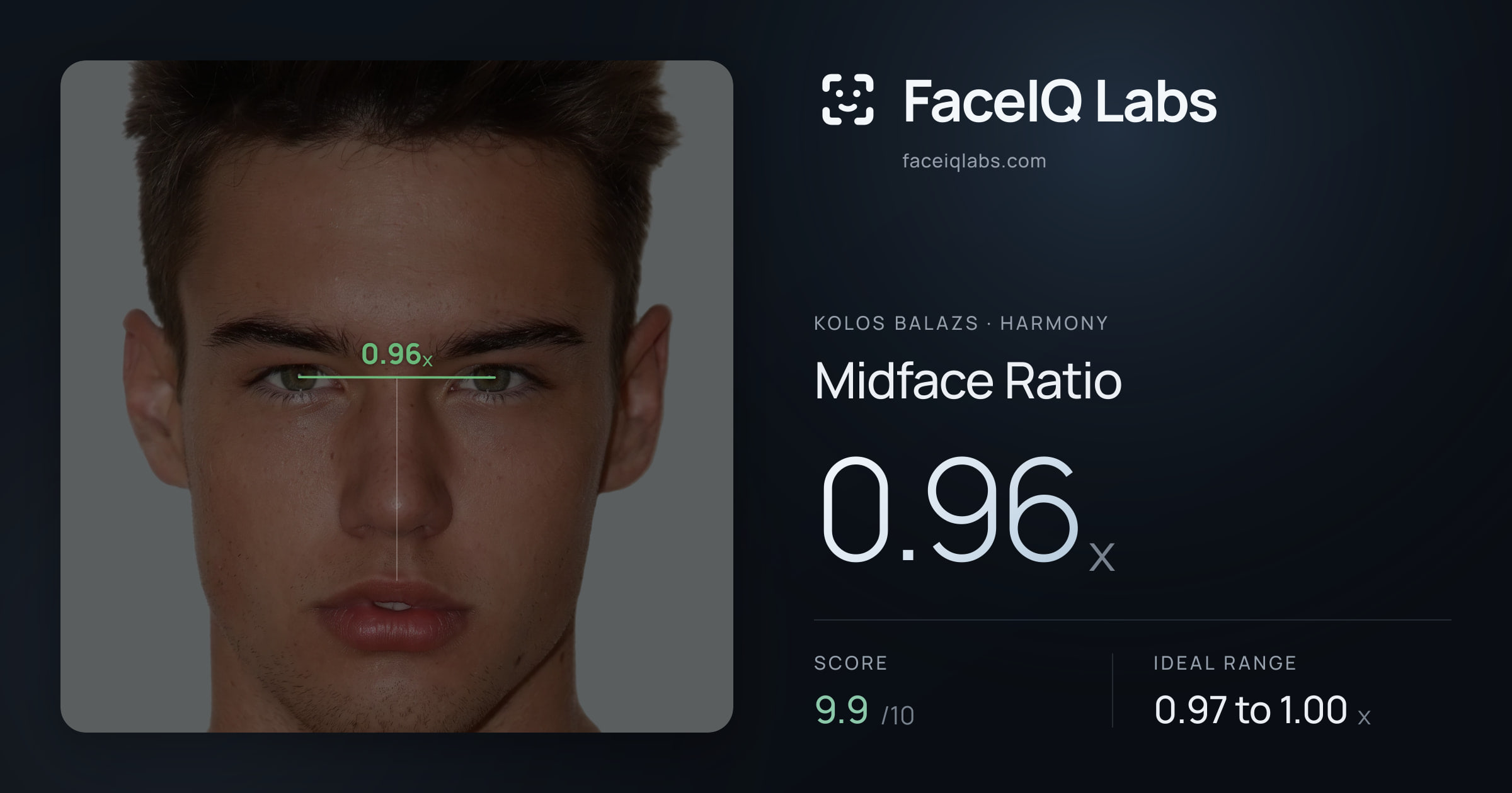 Kolos Balazs Midface Ratio: 0.96x, drawn on the photo