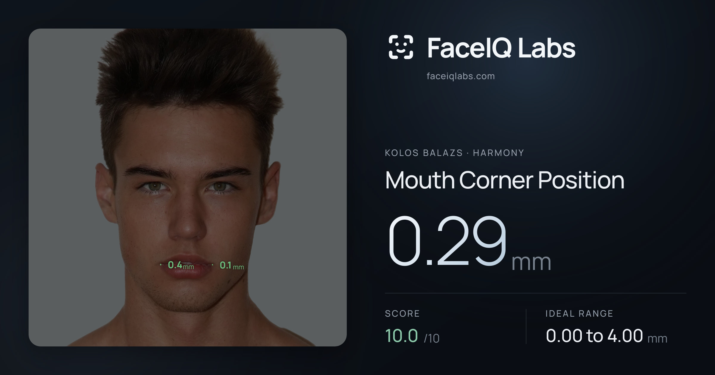 Kolos Balazs Mouth Corner Position: 0.29mm, drawn on the photo