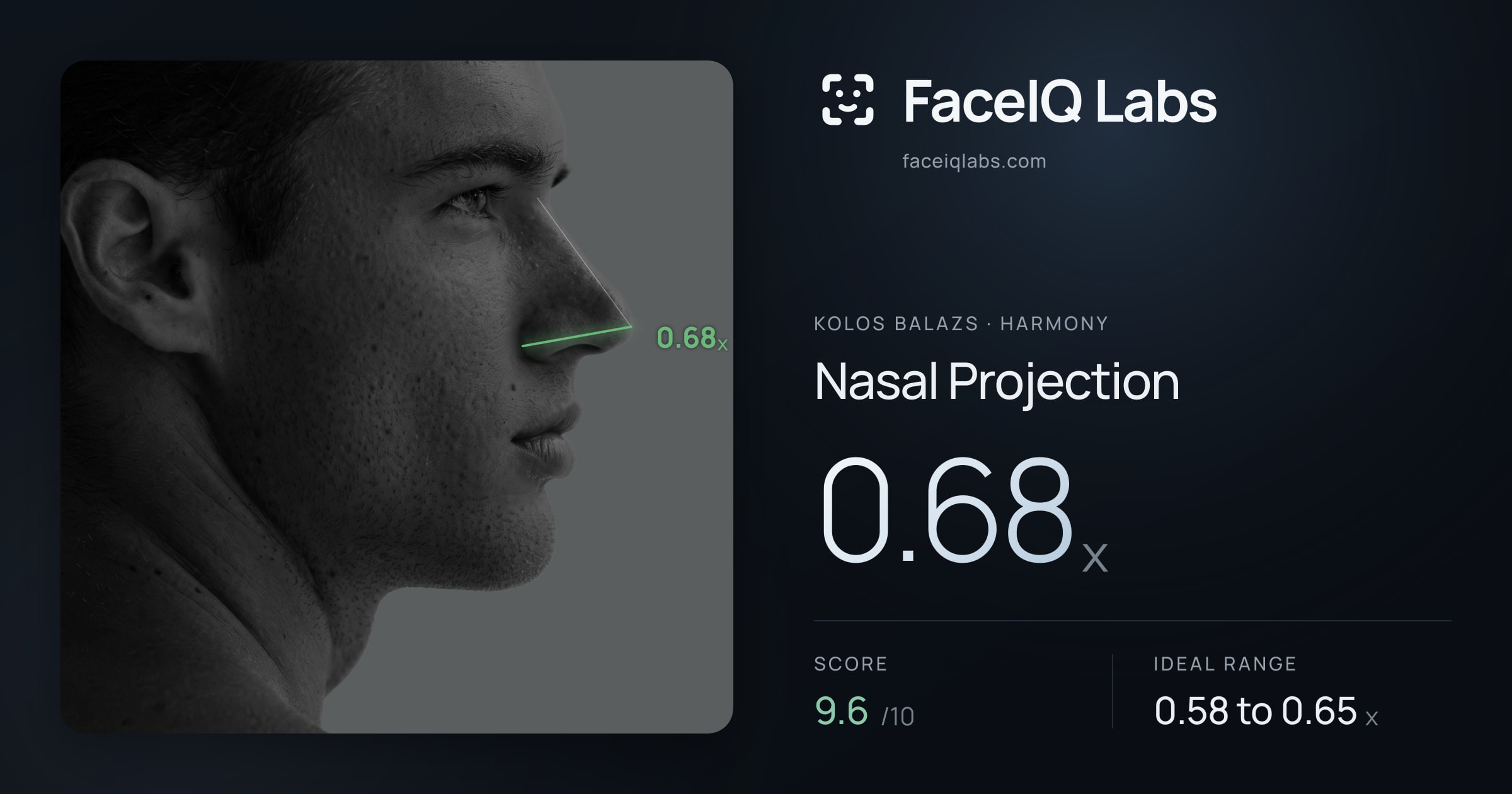 Kolos Balazs Nasal Projection: 0.68x, drawn on the photo