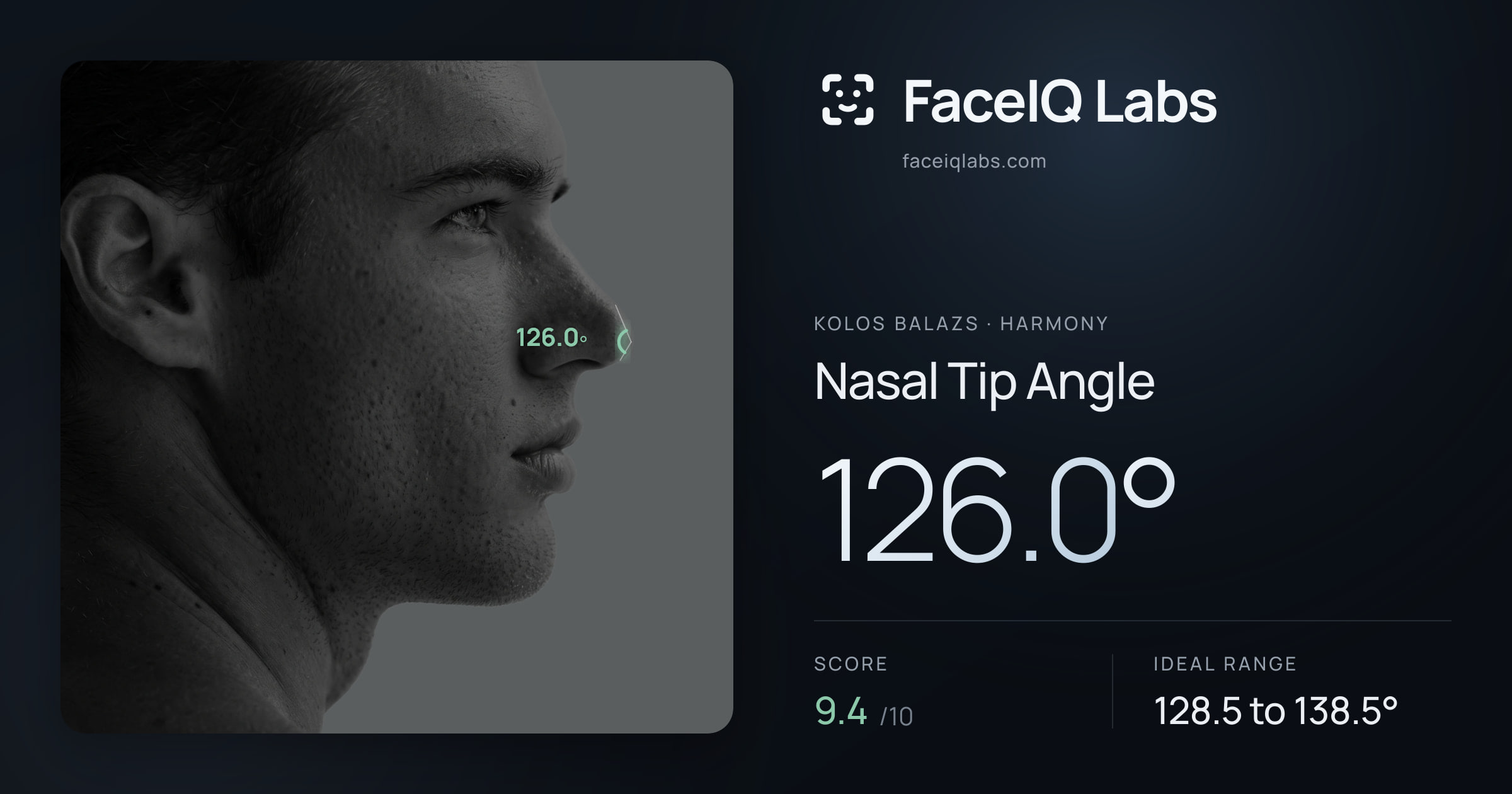 Kolos Balazs Nasal Tip Angle: 126.0°, drawn on the photo