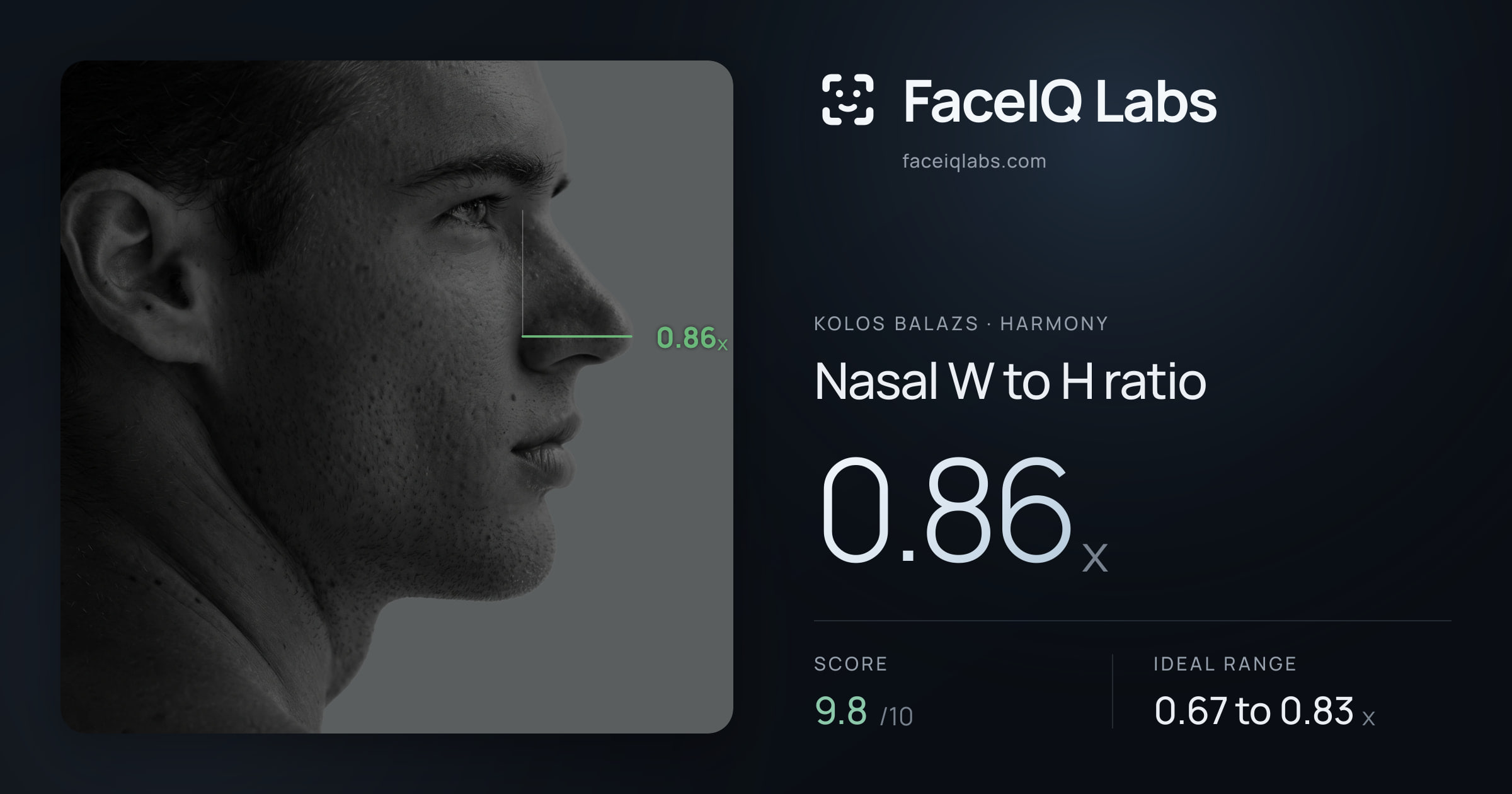 Kolos Balazs Nasal W to H ratio: 0.86x, drawn on the photo