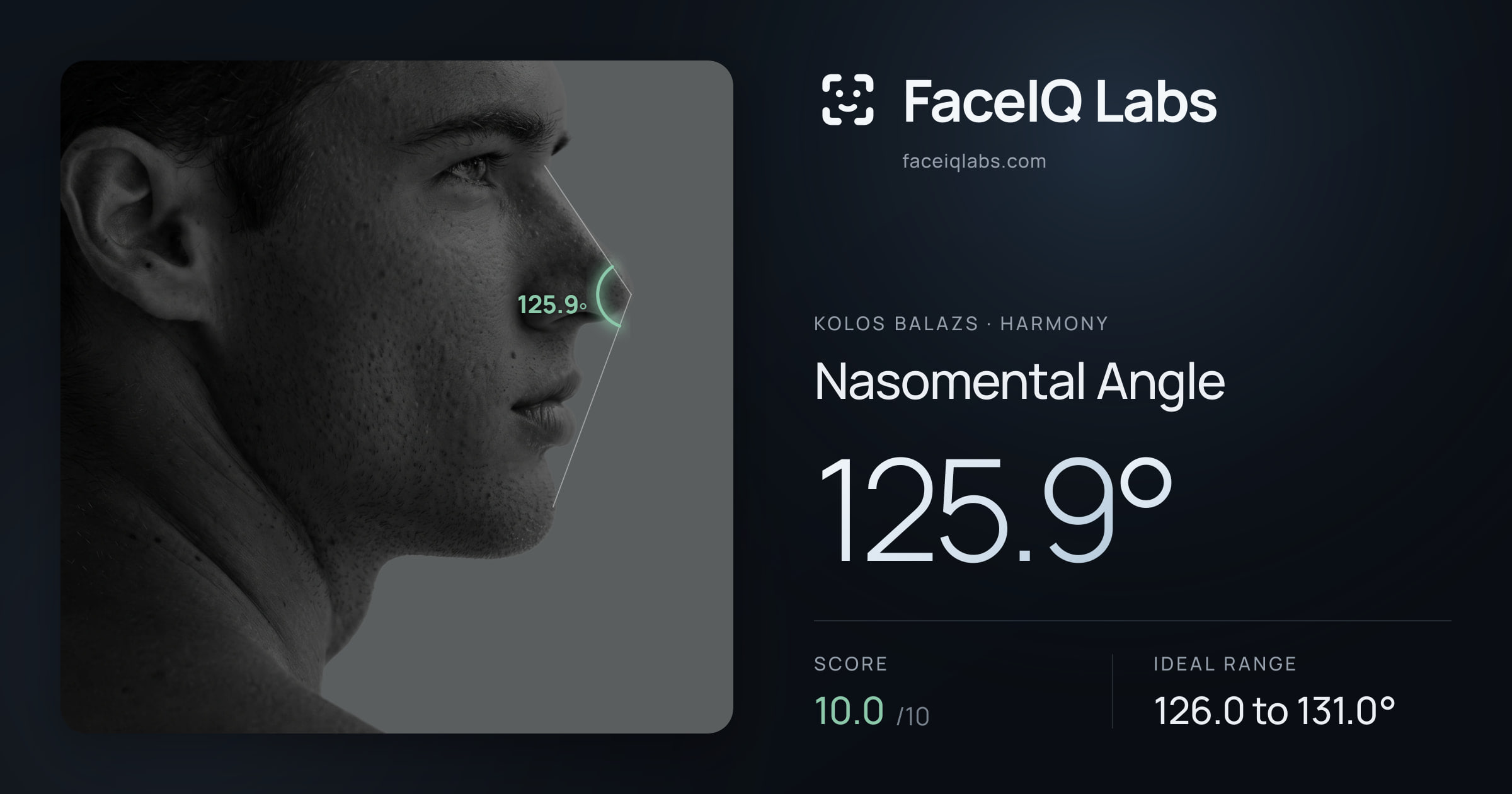 Kolos Balazs Nasomental Angle: 125.9°, drawn on the photo