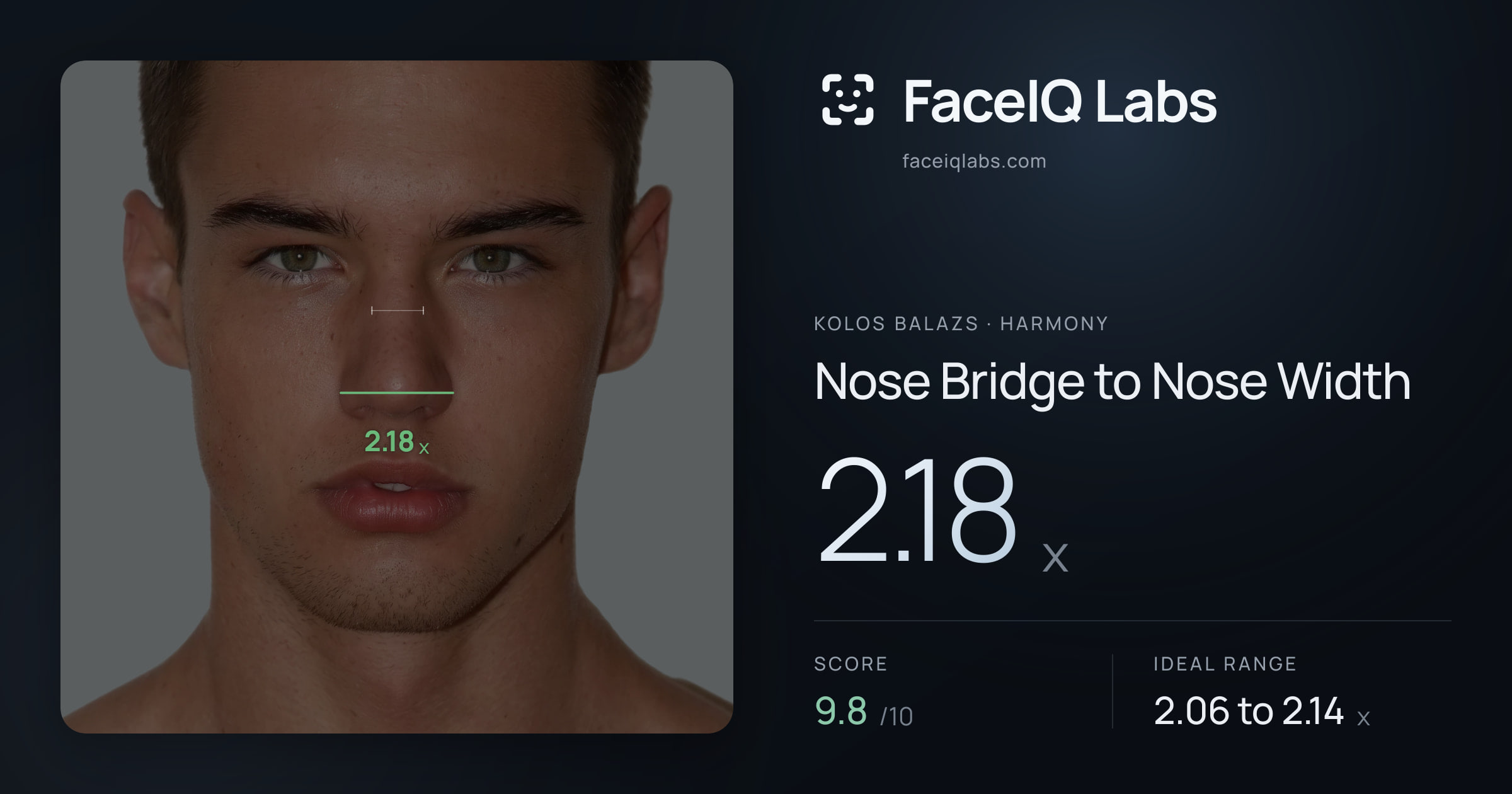 Kolos Balazs Nose Bridge to Nose Width: 2.18x, drawn on the photo
