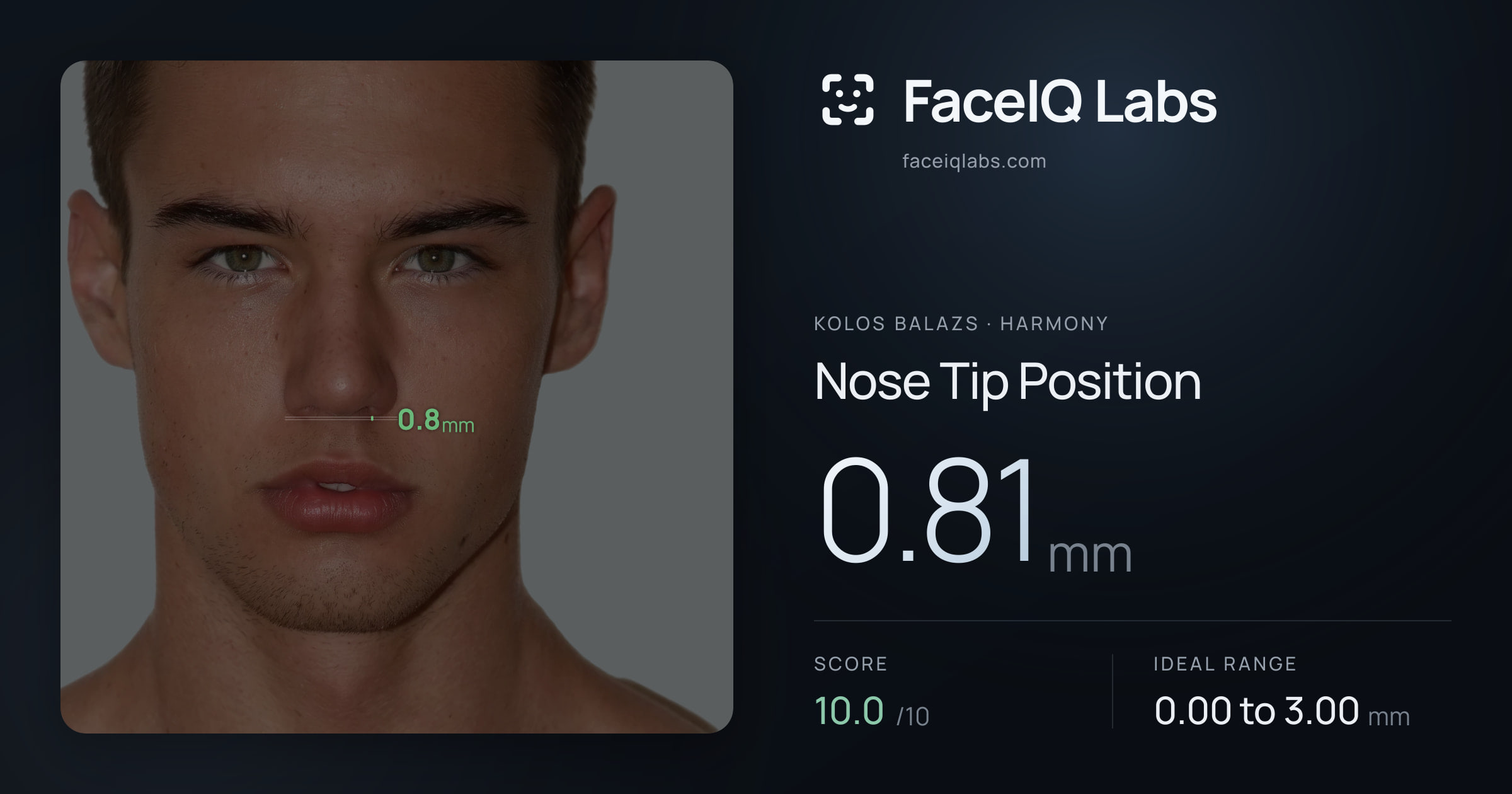 Kolos Balazs Nose Tip Position: 0.81mm, drawn on the photo