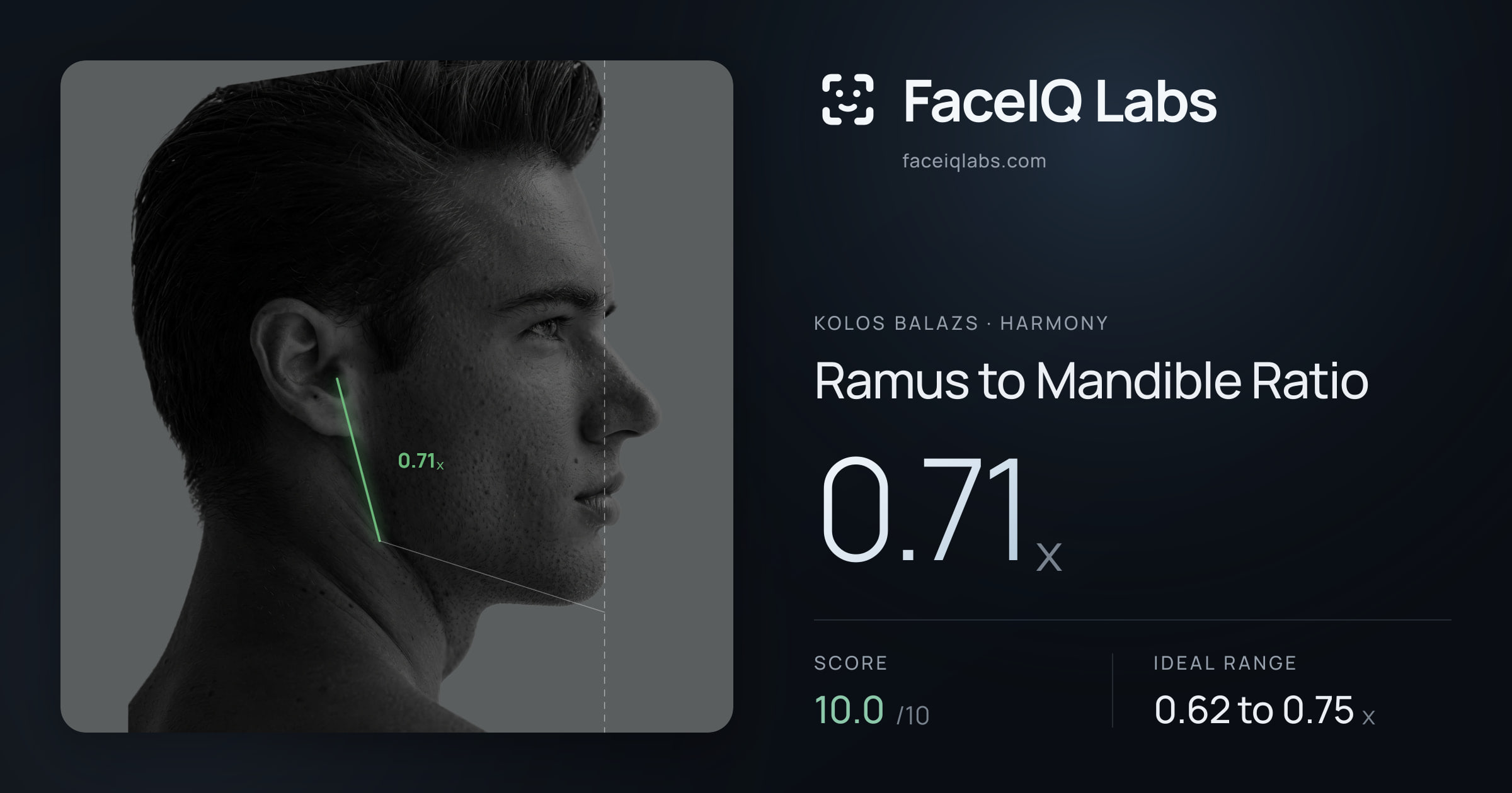 Kolos Balazs Ramus to Mandible Ratio: 0.71x, drawn on the photo