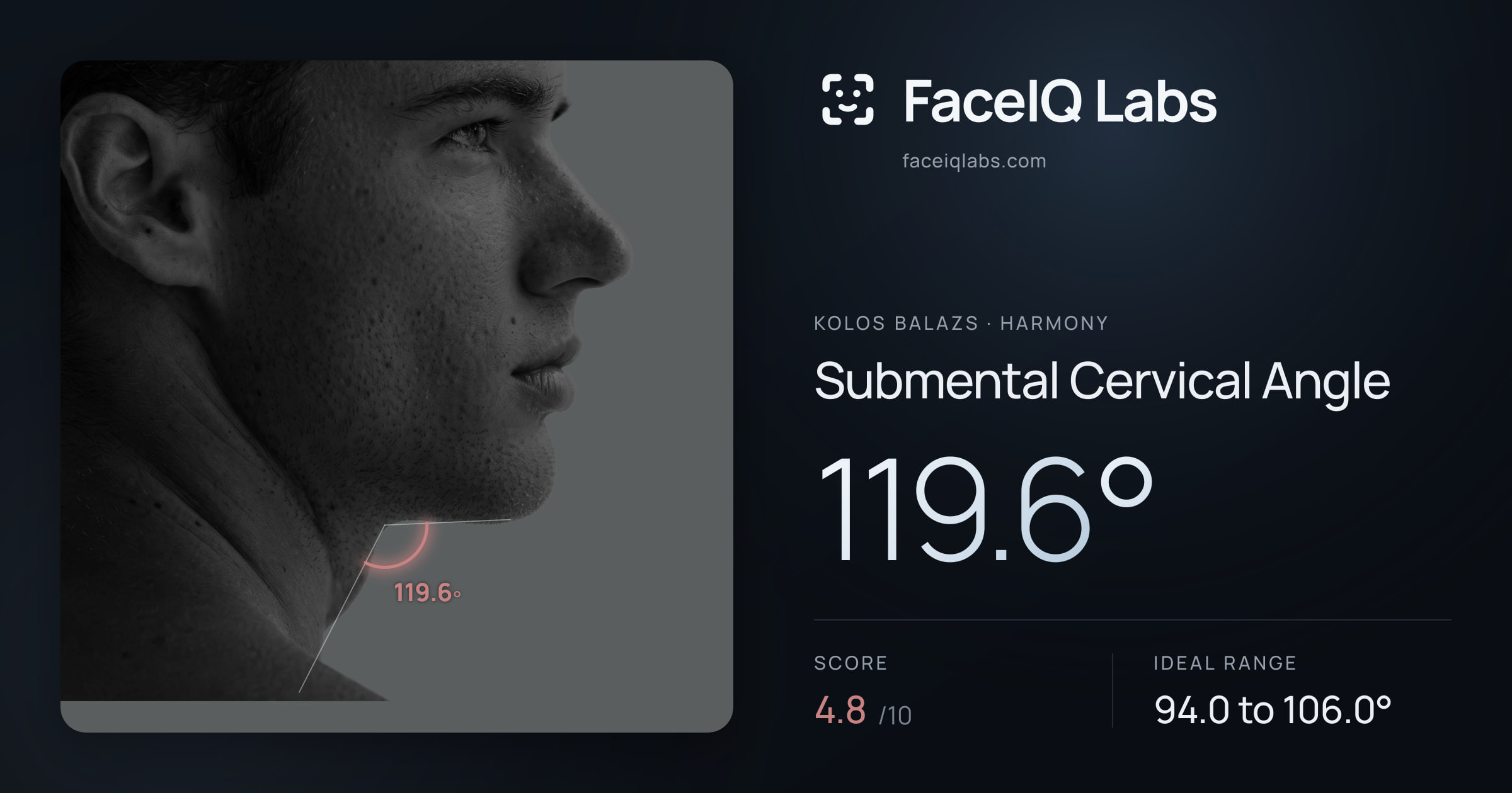 Kolos Balazs Submental Cervical Angle: 119.6°, drawn on the photo
