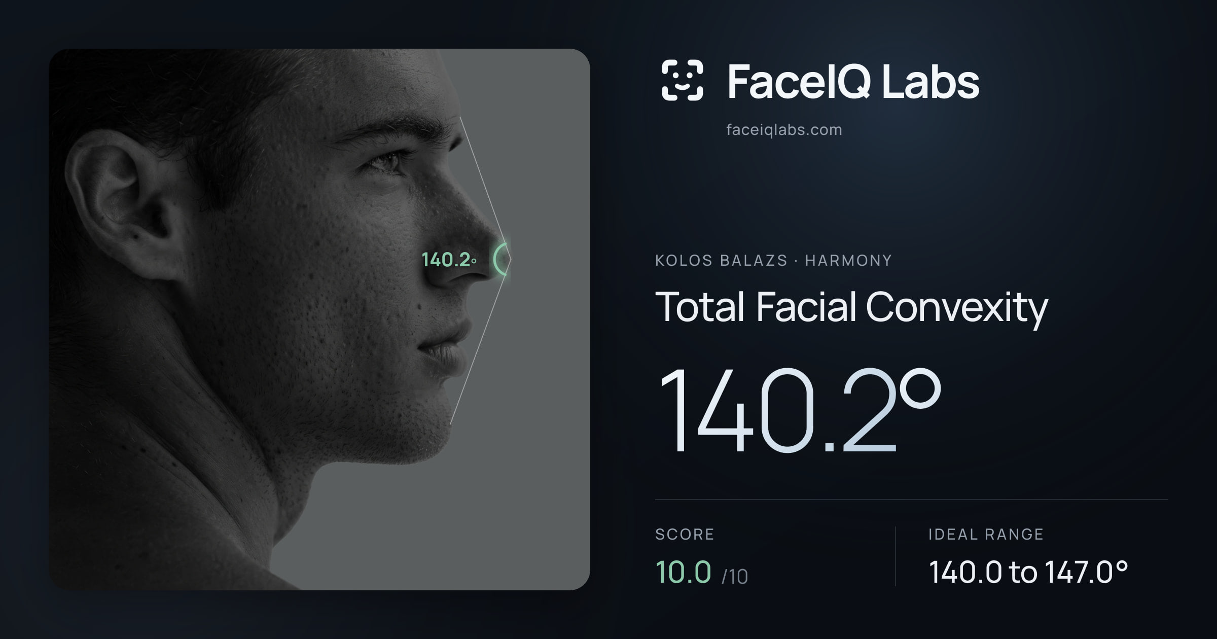 Kolos Balazs Total Facial Convexity: 140.2°, drawn on the photo
