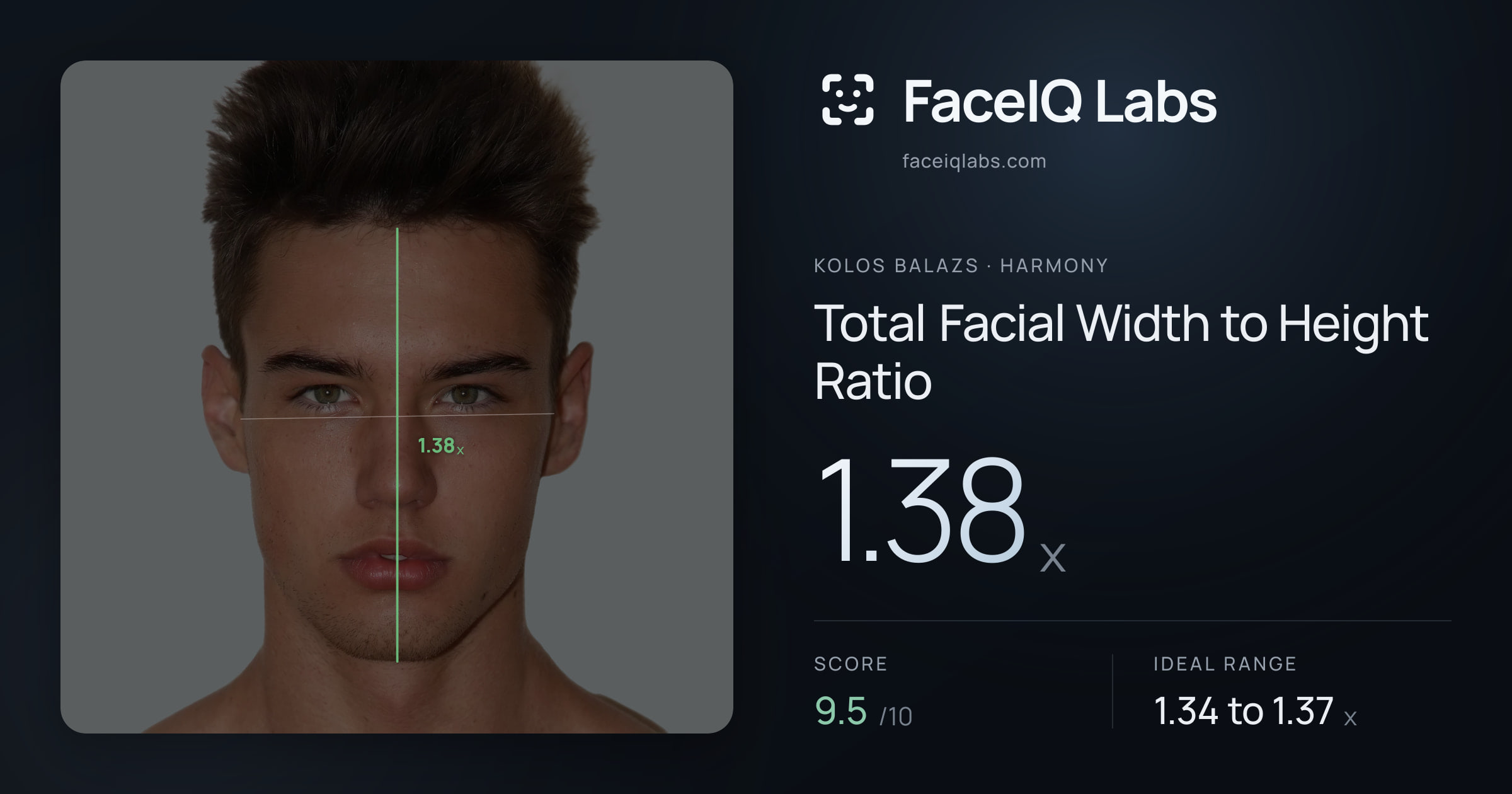 Kolos Balazs Total Facial Width to Height Ratio: 1.38x, drawn on the photo