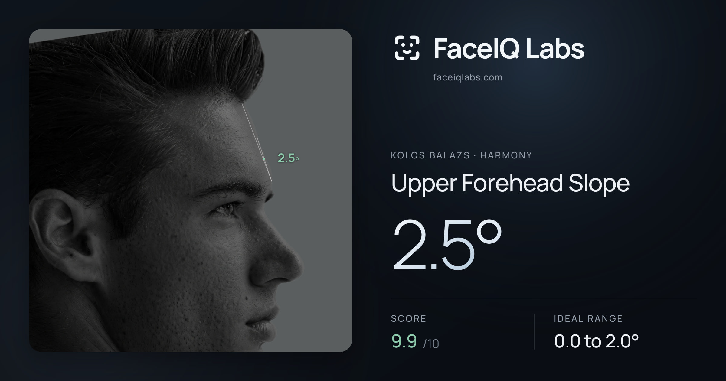 Kolos Balazs Upper Forehead Slope: 2.5°, drawn on the photo