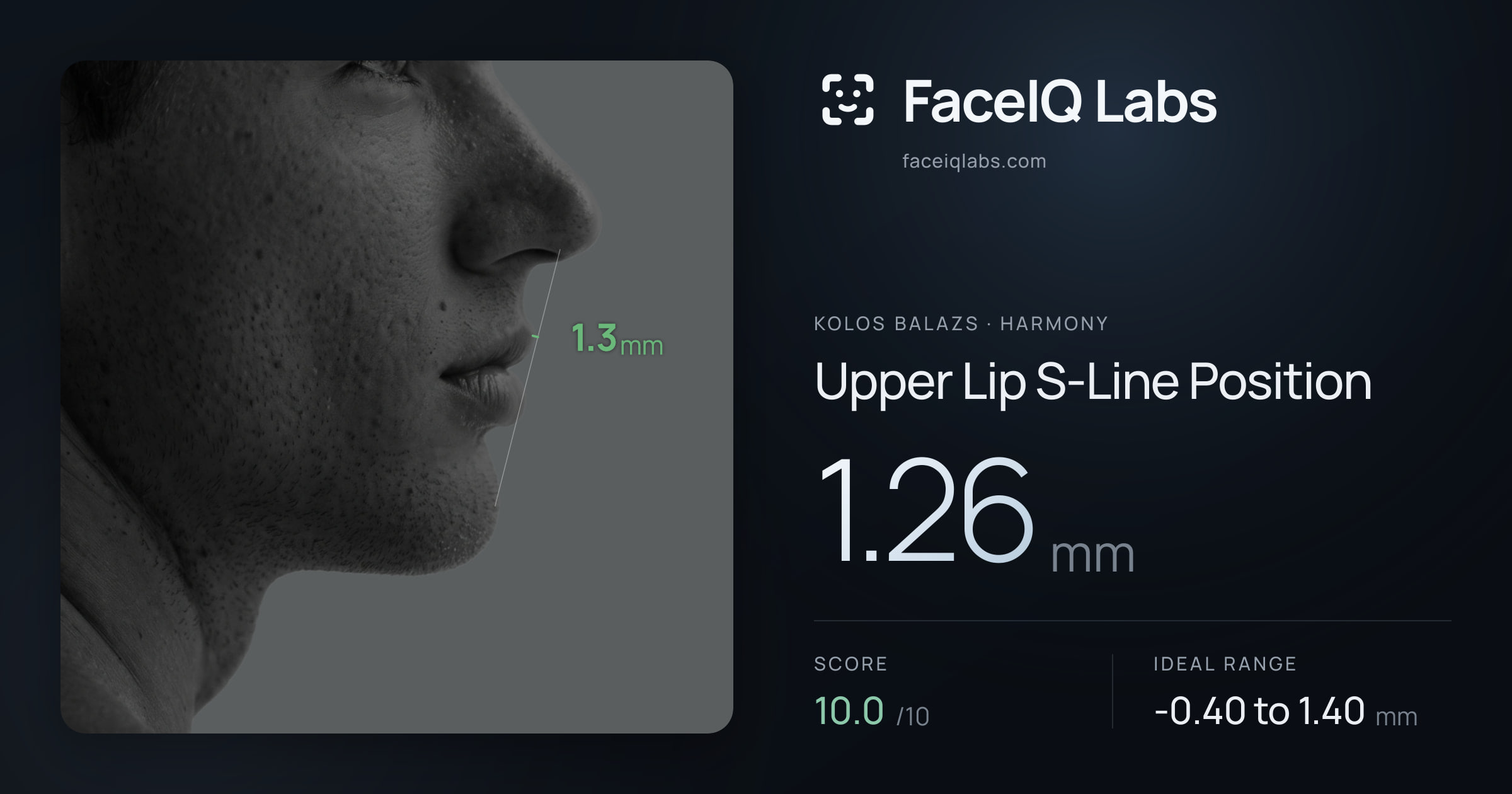 Kolos Balazs Upper Lip S-Line Position: 1.26mm, drawn on the photo