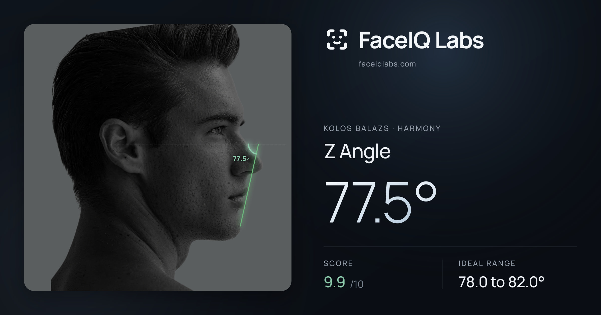 Kolos Balazs Z Angle: 77.5°, drawn on the photo