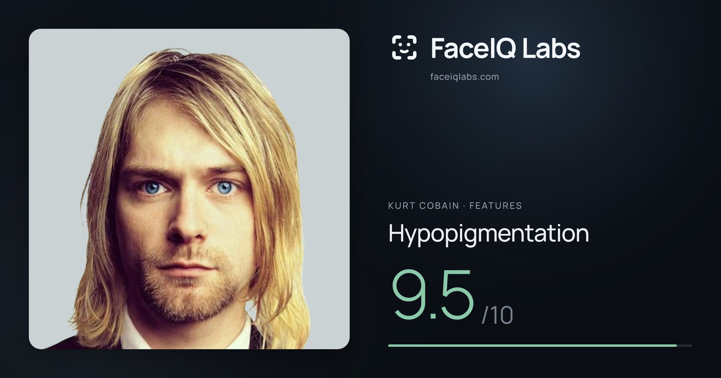 Kurt Cobain Hypopigmentation: 9.5/10, drawn on the photo