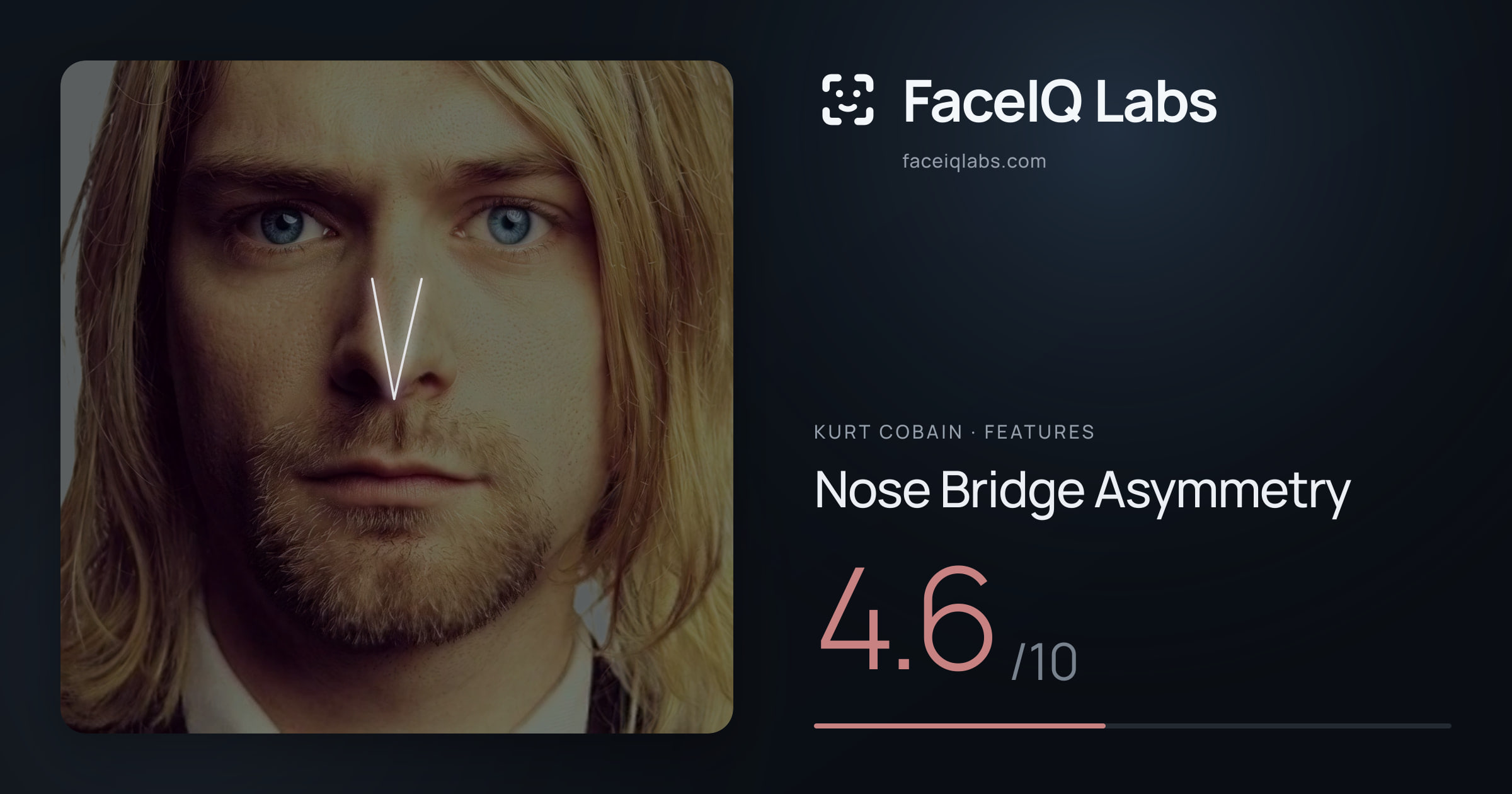 Kurt Cobain Nose Bridge Asymmetry: 4.6/10, drawn on the photo