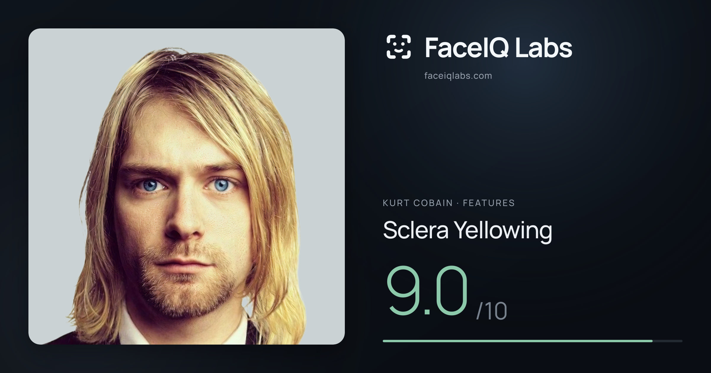 Kurt Cobain Sclera Yellowing: 9.0/10, drawn on the photo