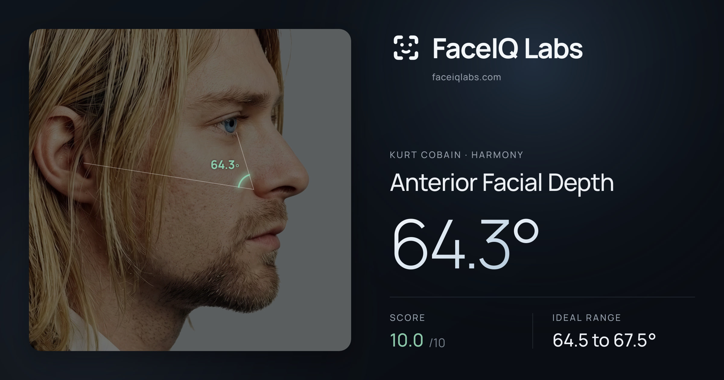 Kurt Cobain Anterior Facial Depth: 64.3°, drawn on the photo