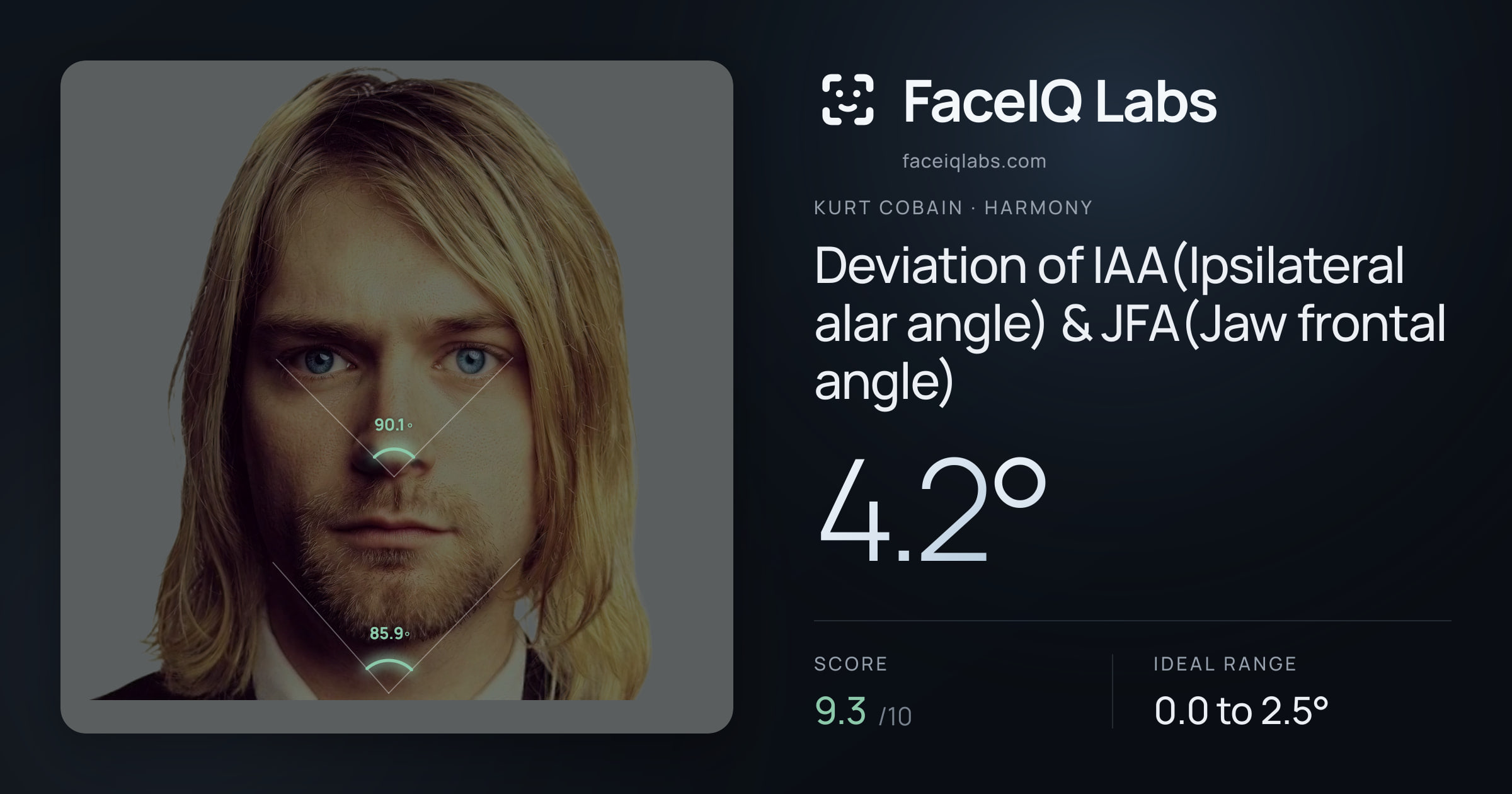 Kurt Cobain Deviation of IAA(Ipsilateral alar angle) & JFA(Jaw frontal angle): 4.2°, drawn on the photo