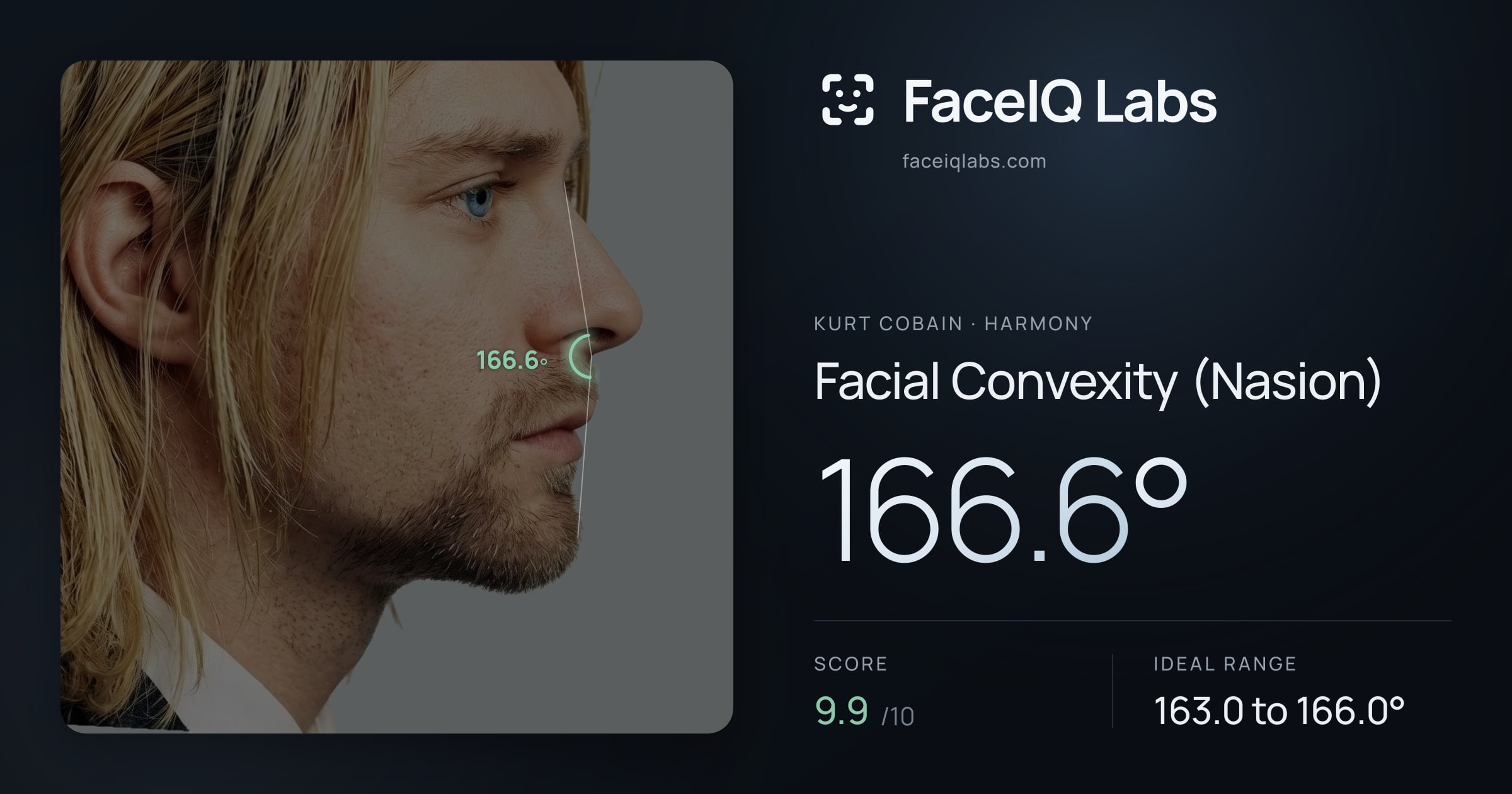 Kurt Cobain Facial Convexity (Nasion): 166.6°, drawn on the photo