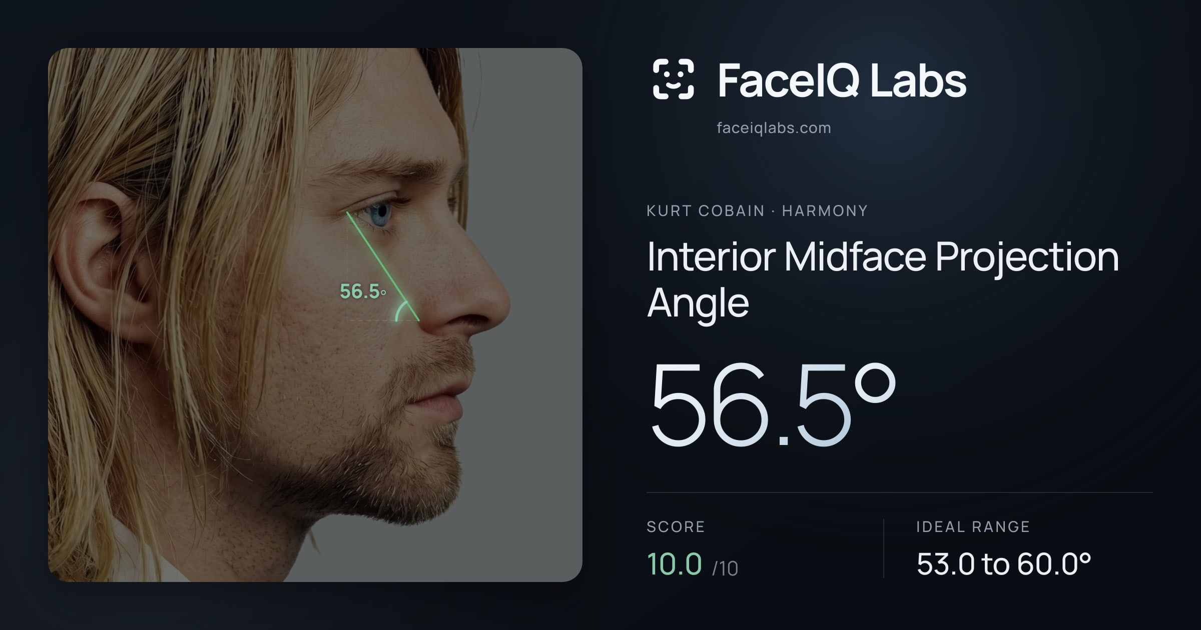 Kurt Cobain Interior Midface Projection Angle: 56.5°, drawn on the photo