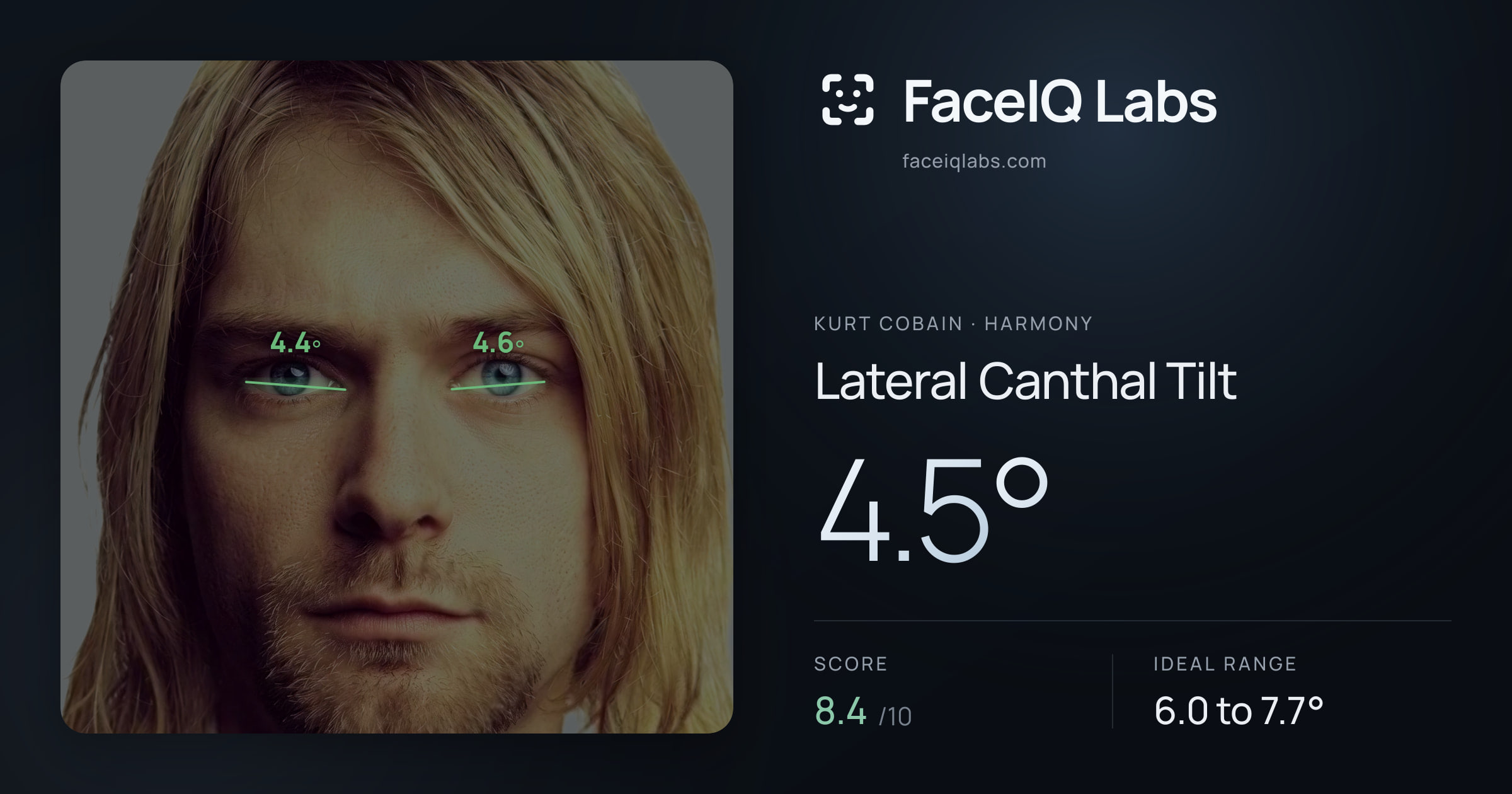 Kurt Cobain Lateral Canthal Tilt: 4.5°, drawn on the photo