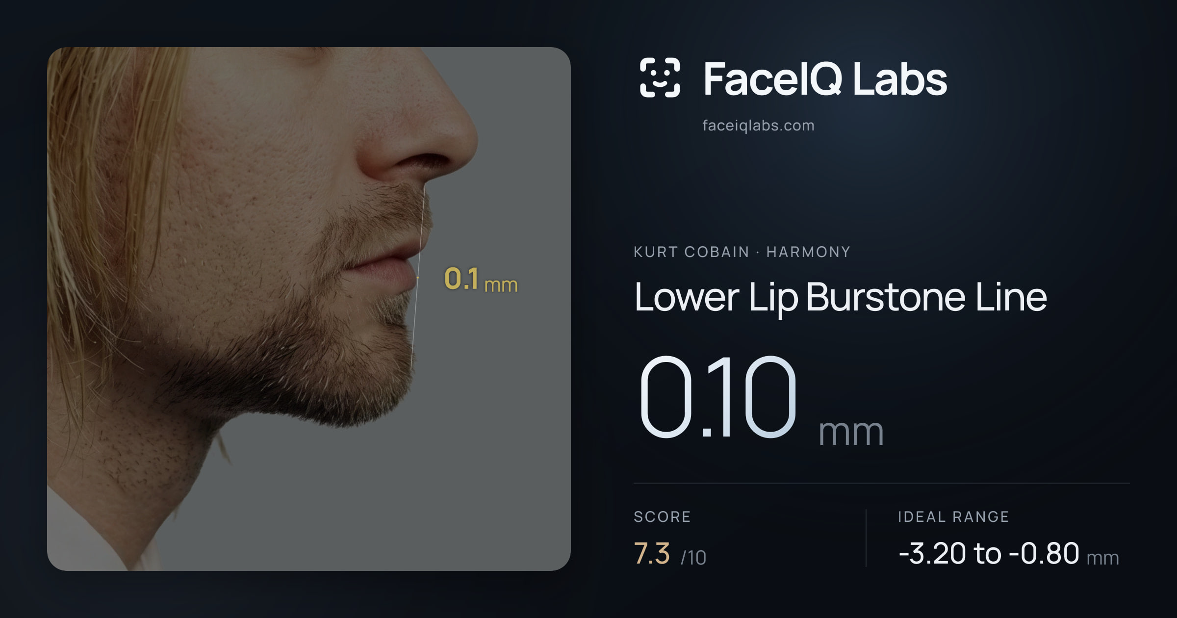 Kurt Cobain Lower Lip Burstone Line: 0.10mm, drawn on the photo