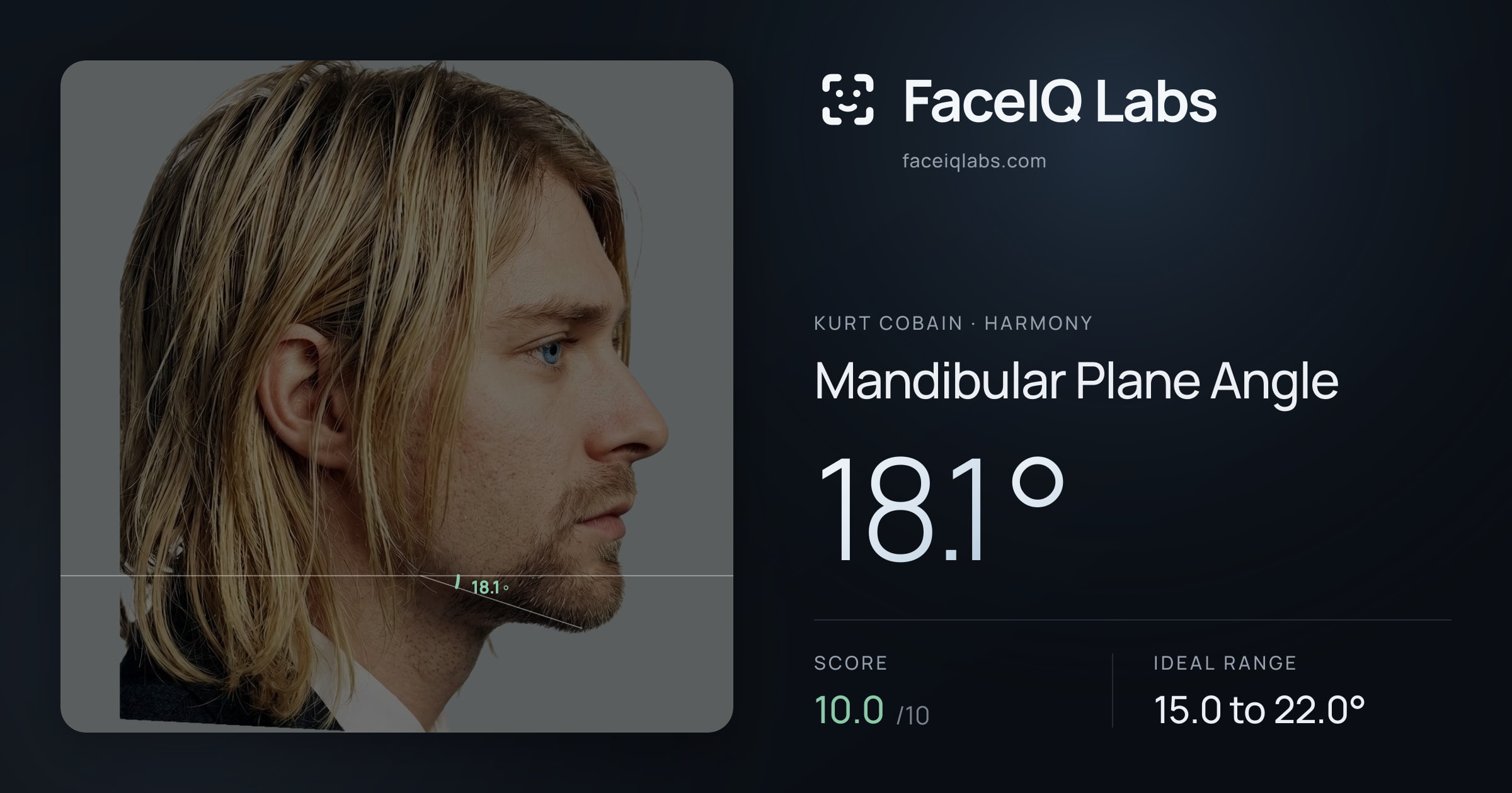 Kurt Cobain Mandibular Plane Angle: 18.1°, drawn on the photo