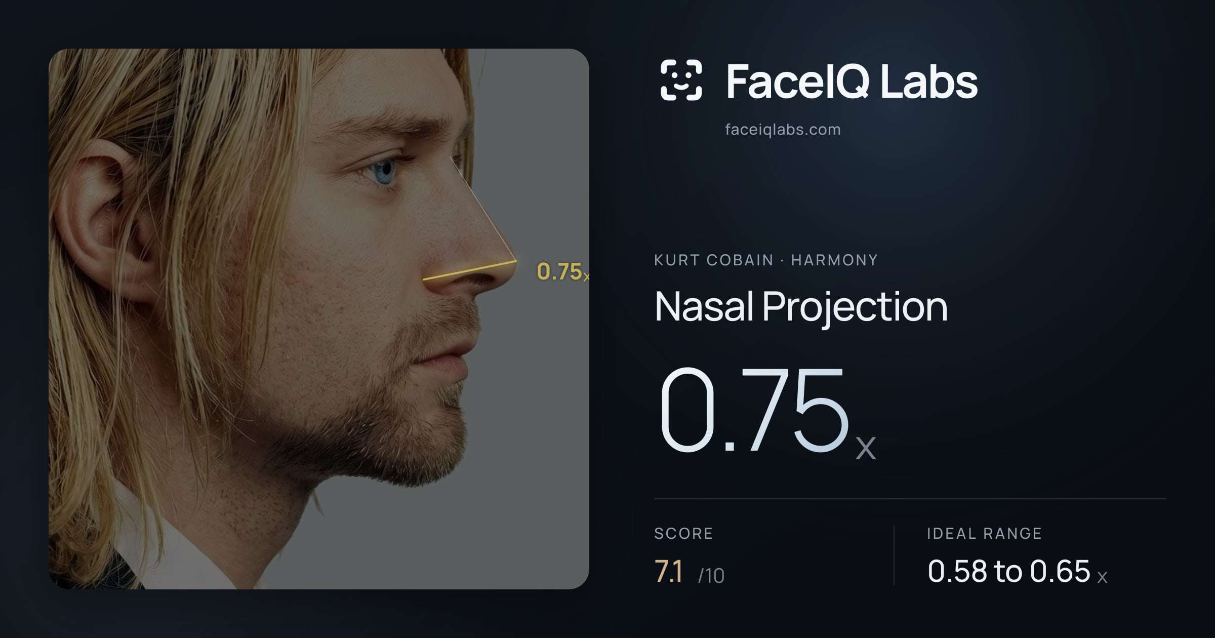 Kurt Cobain Nasal Projection: 0.75x, drawn on the photo