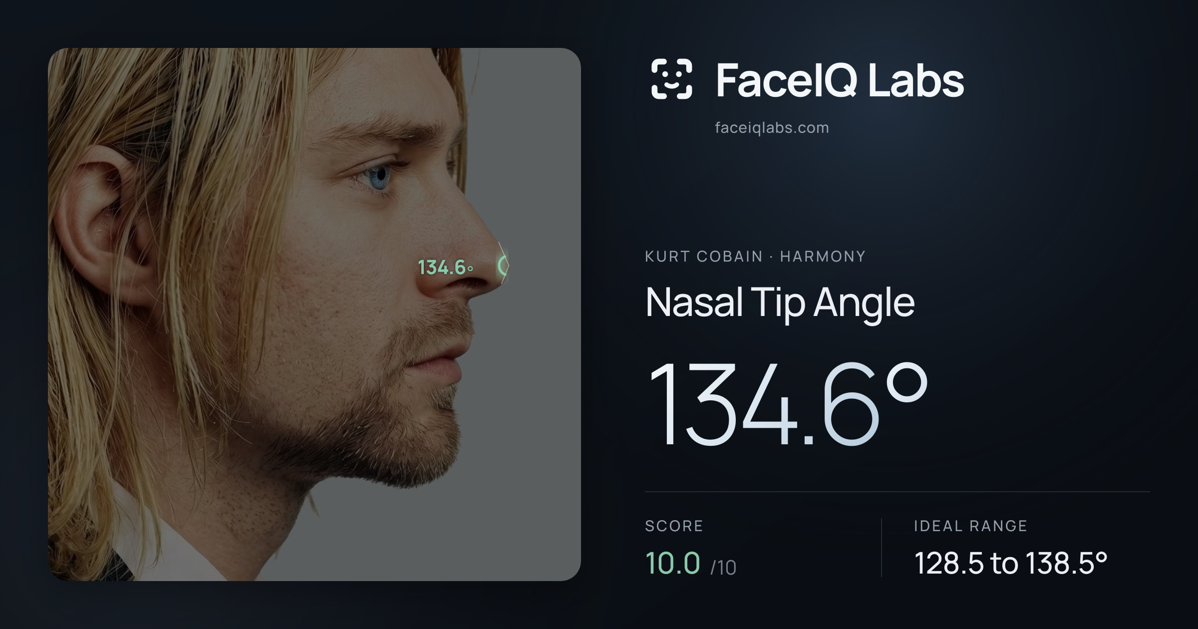 Kurt Cobain Nasal Tip Angle: 134.6°, drawn on the photo
