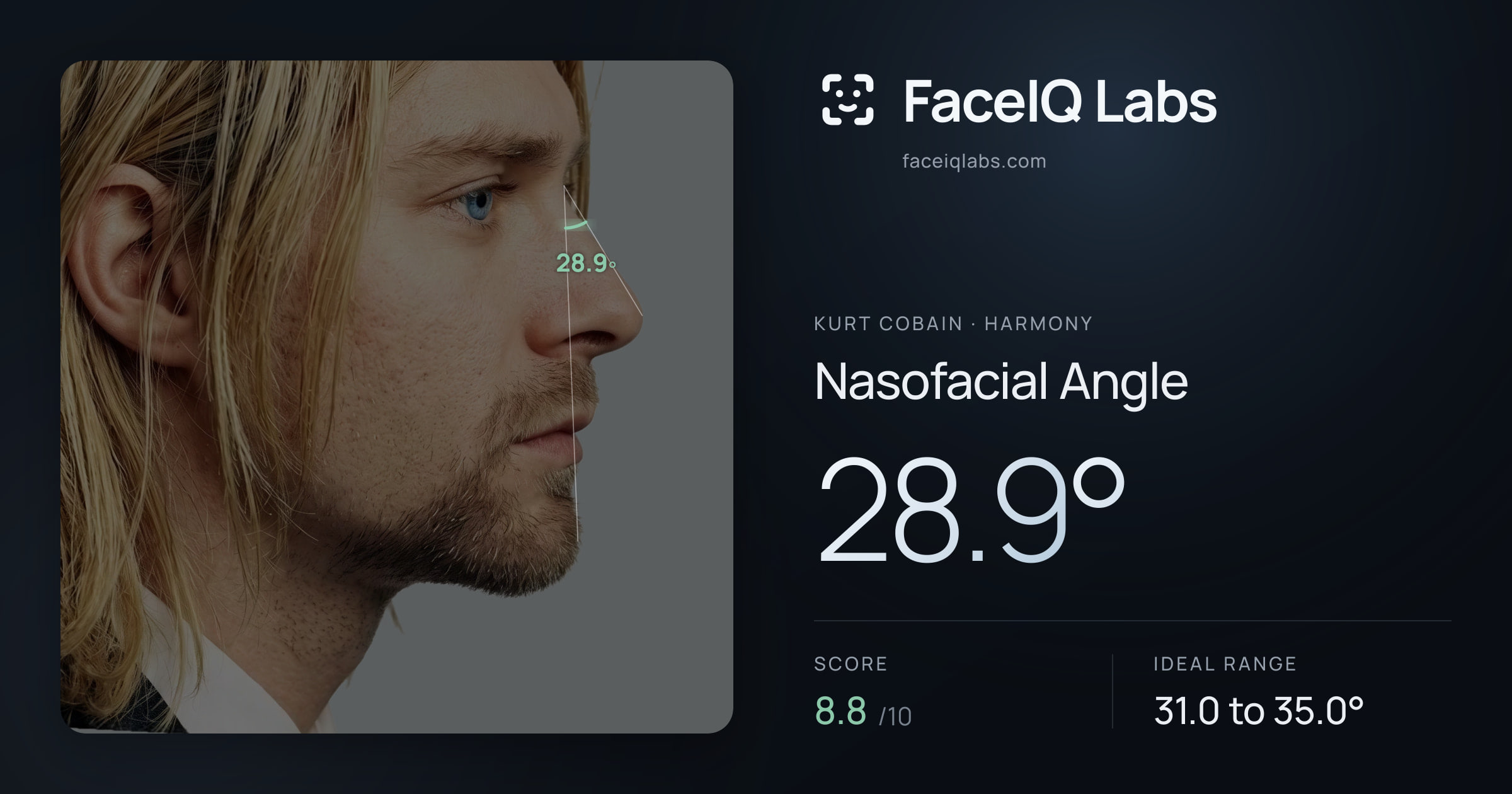 Kurt Cobain Nasofacial Angle: 28.9°, drawn on the photo