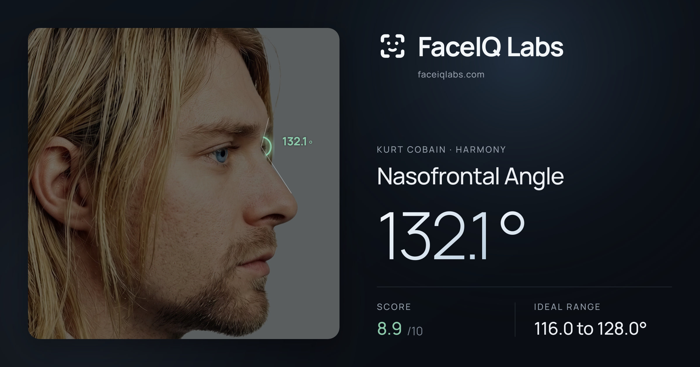 Kurt Cobain Nasofrontal Angle: 132.1°, drawn on the photo