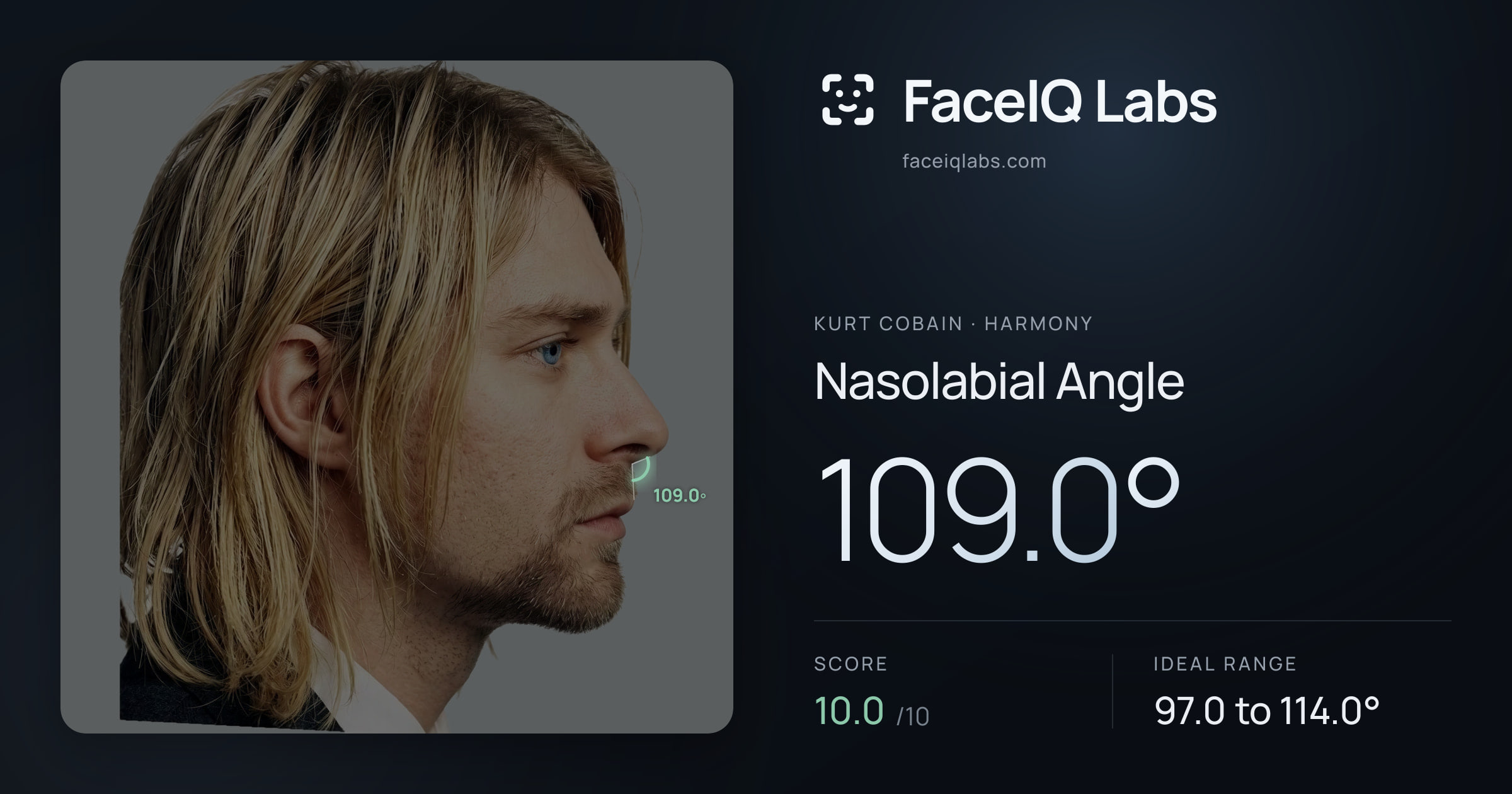 Kurt Cobain Nasolabial Angle: 109.0°, drawn on the photo