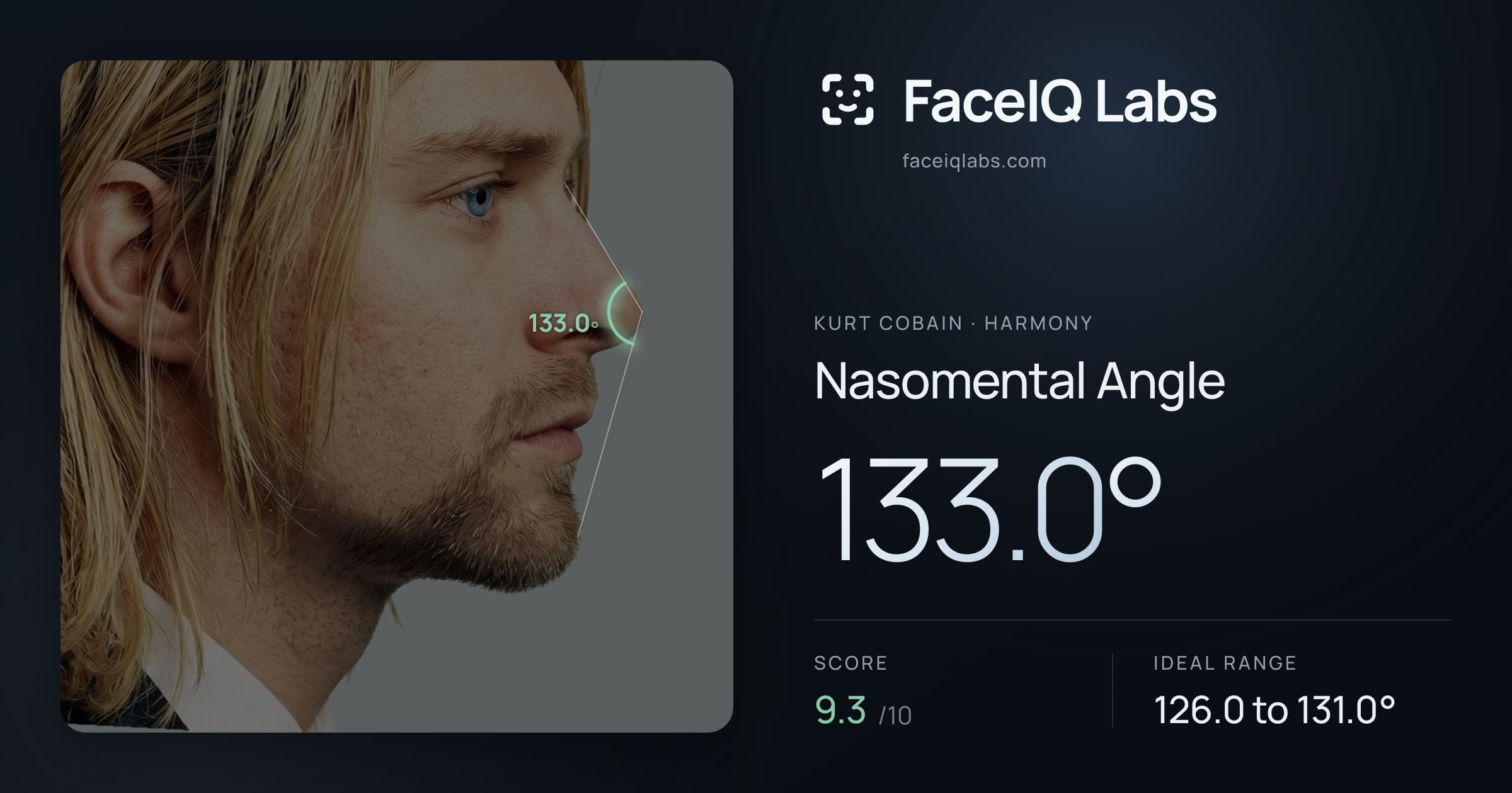 Kurt Cobain Nasomental Angle: 133.0°, drawn on the photo