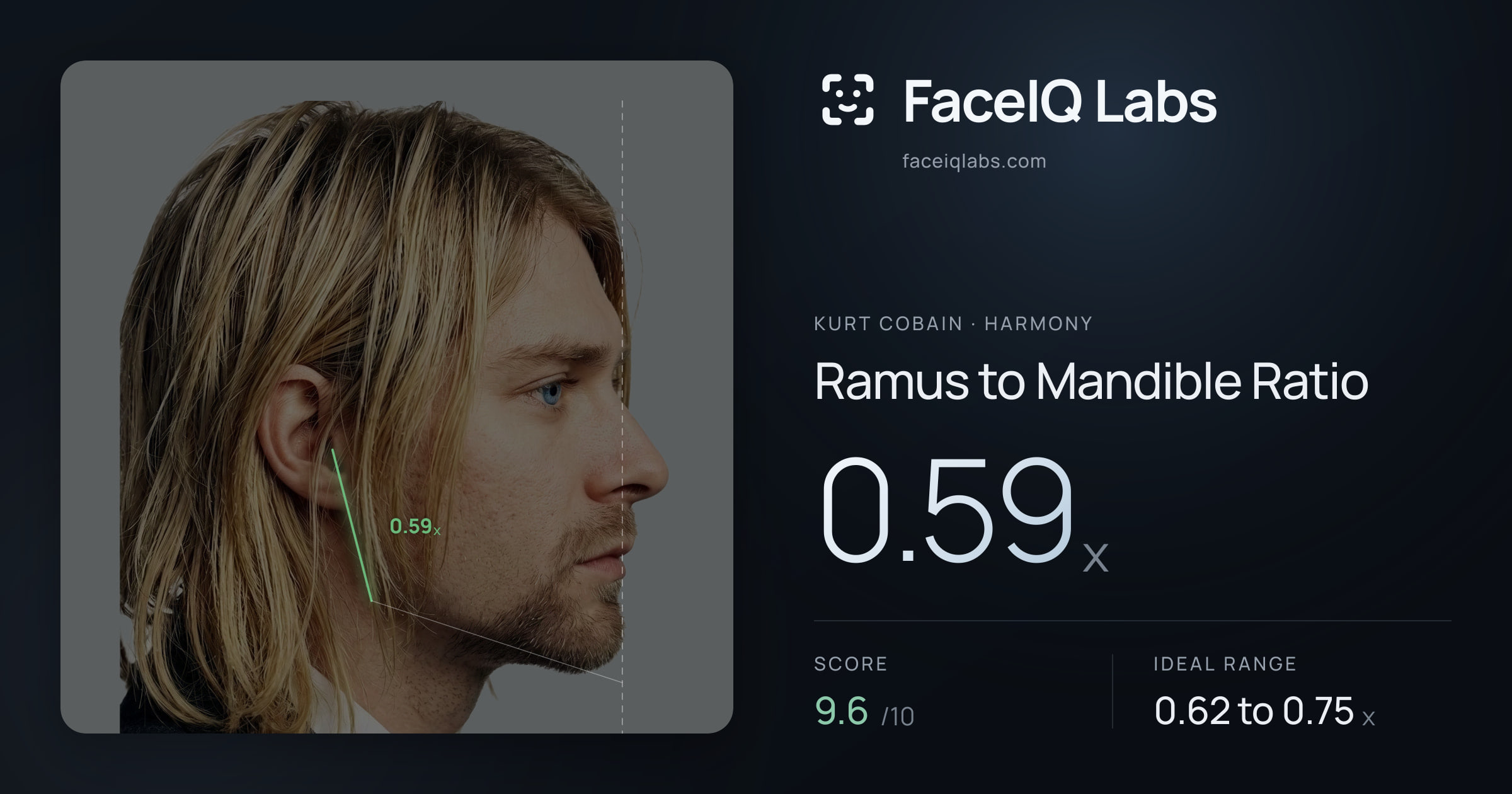 Kurt Cobain Ramus to Mandible Ratio: 0.59x, drawn on the photo