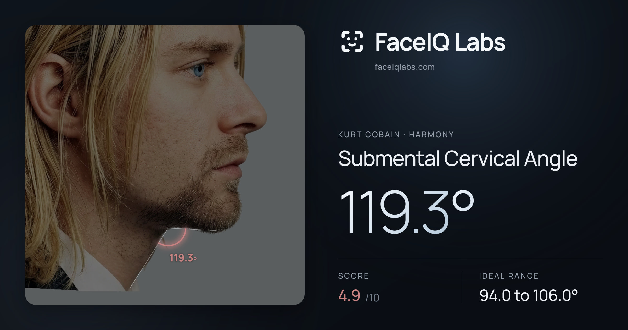 Kurt Cobain Submental Cervical Angle: 119.3°, drawn on the photo