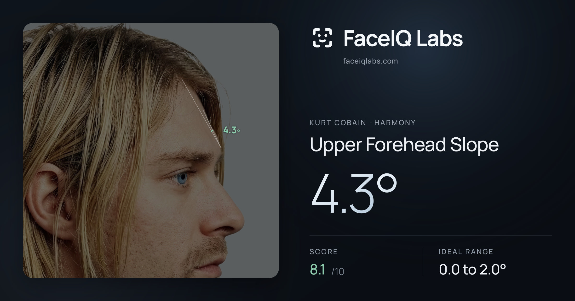 Kurt Cobain Upper Forehead Slope: 4.3°, drawn on the photo