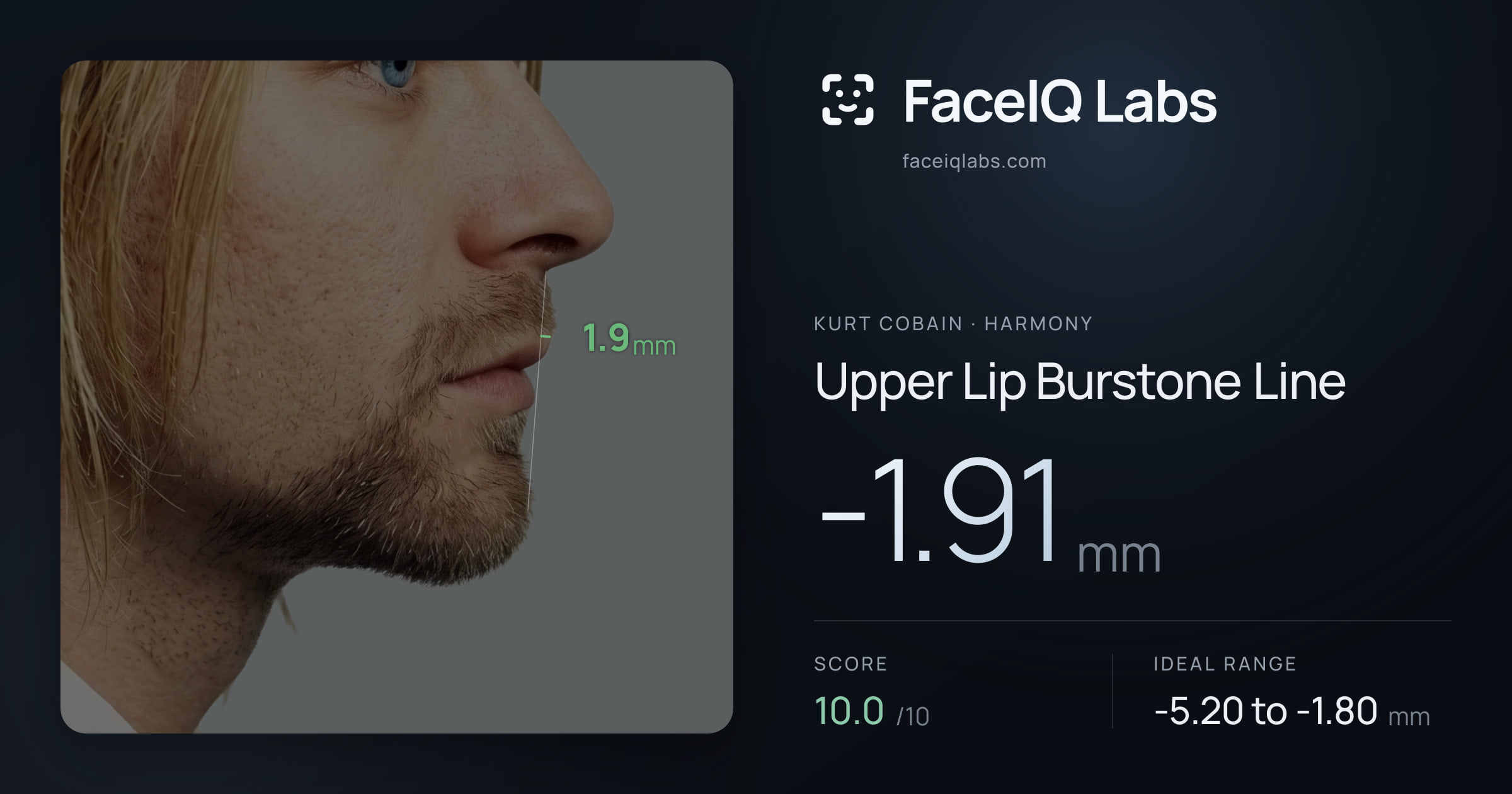 Kurt Cobain Upper Lip Burstone Line: -1.91mm, drawn on the photo