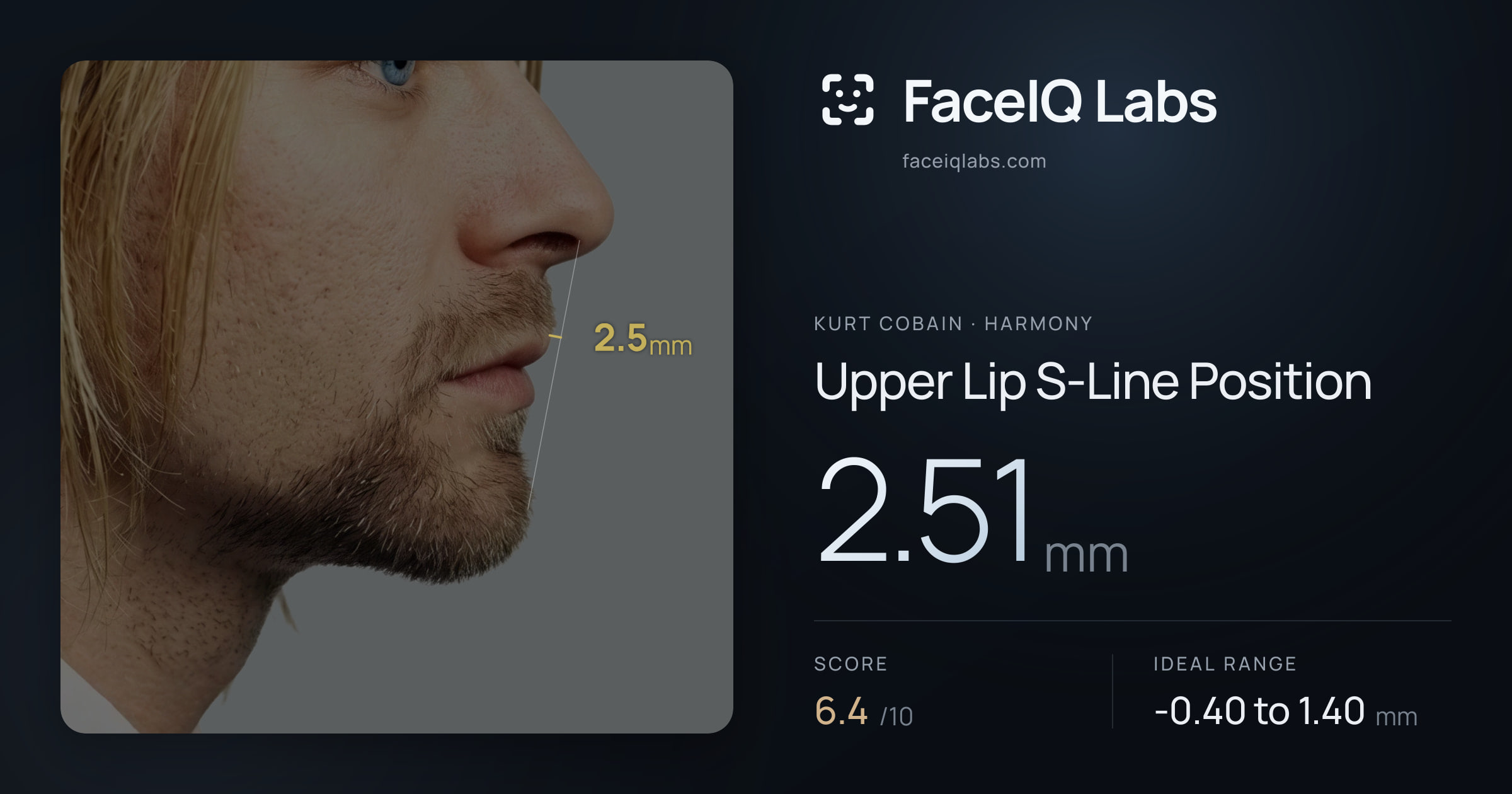 Kurt Cobain Upper Lip S-Line Position: 2.51mm, drawn on the photo