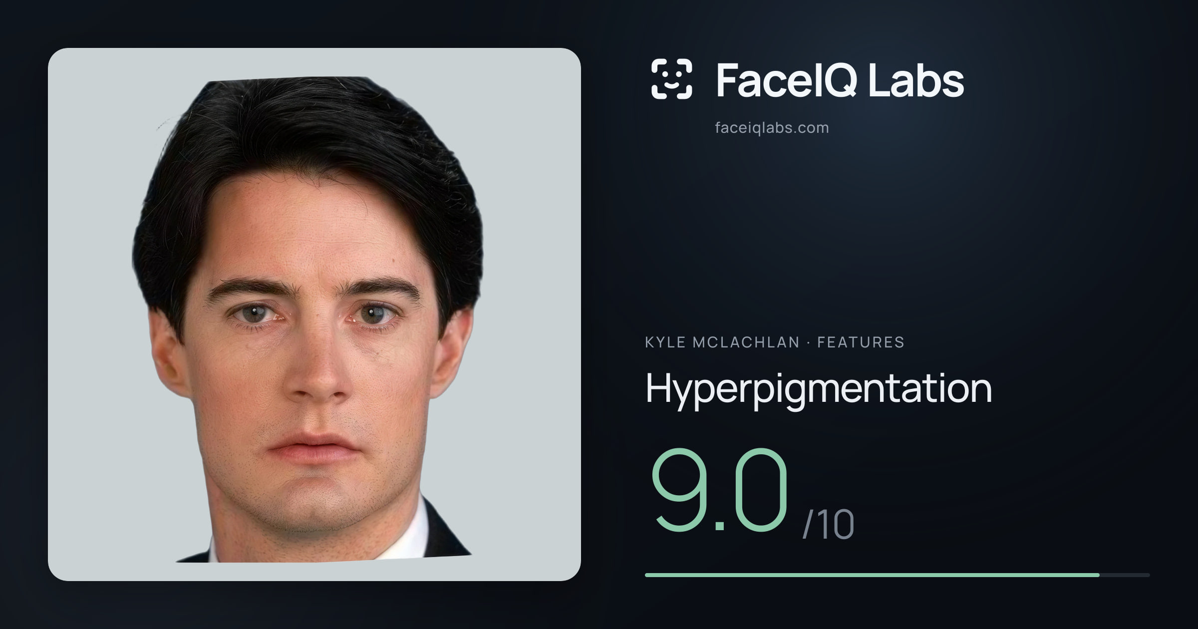 Kyle McLachlan Hyperpigmentation: 9.0/10, drawn on the photo
