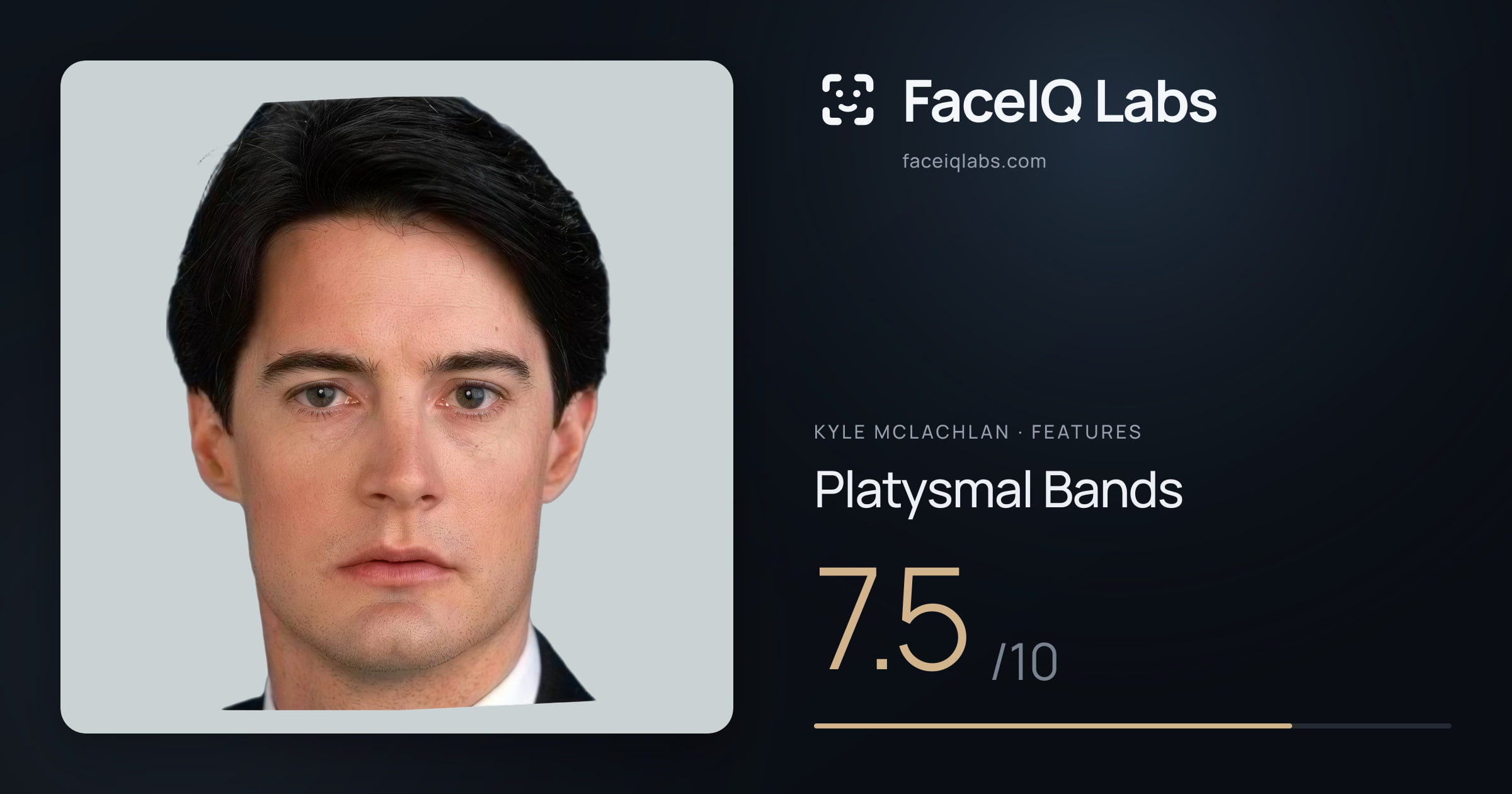 Kyle McLachlan Platysmal Bands: 7.5/10, drawn on the photo