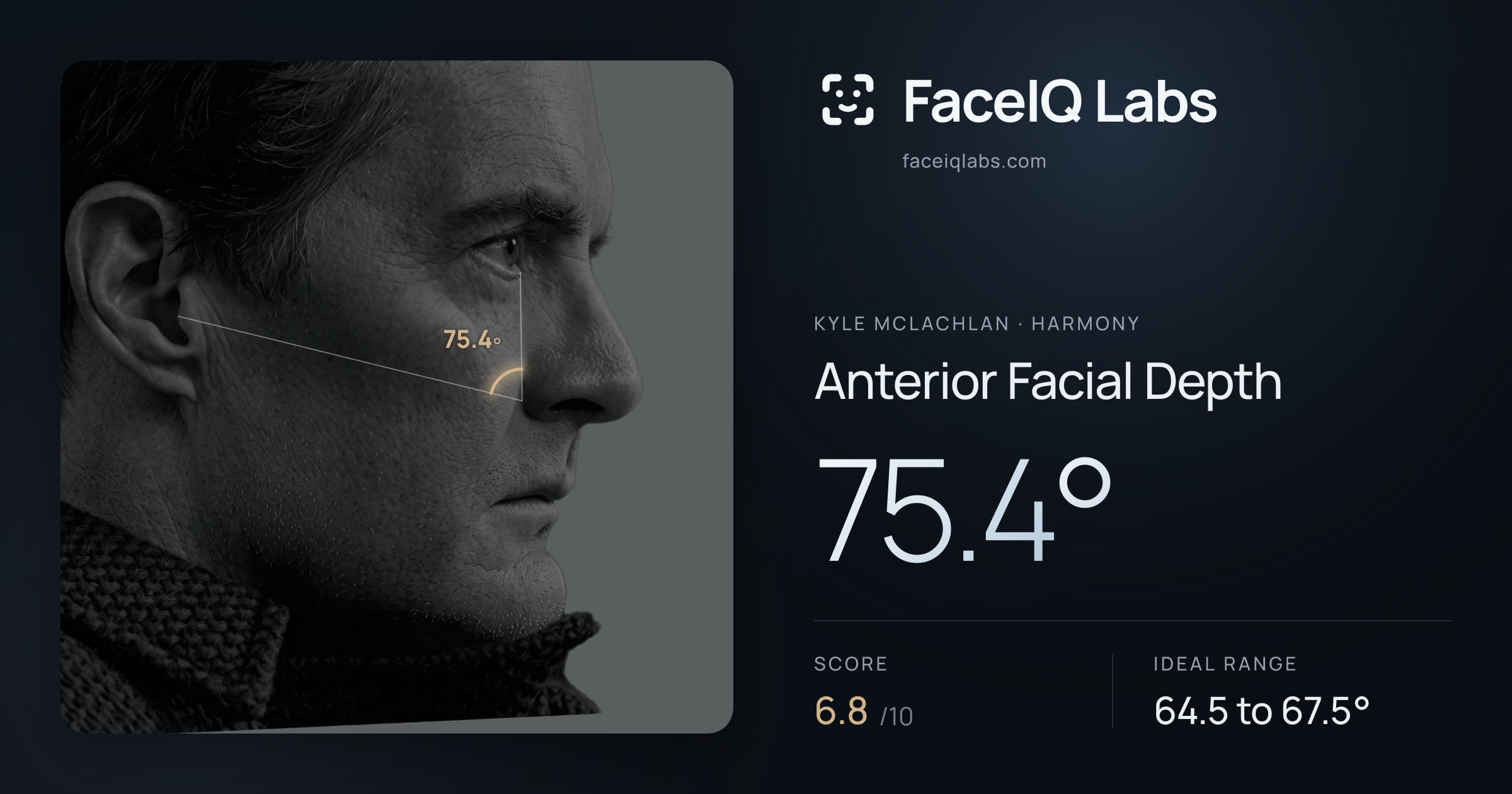 Kyle McLachlan Anterior Facial Depth: 75.4°, drawn on the photo