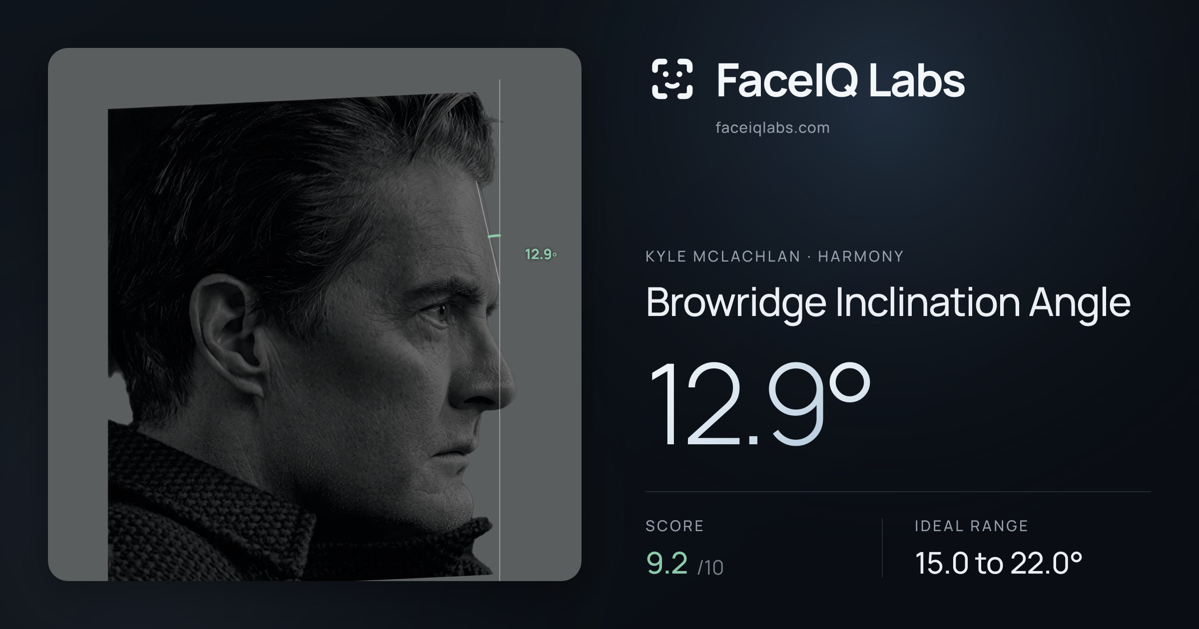 Kyle McLachlan Browridge Inclination Angle: 12.9°, drawn on the photo