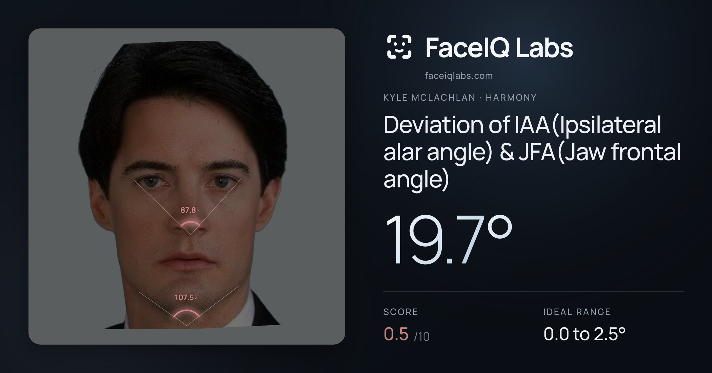 Kyle McLachlan Deviation of IAA(Ipsilateral alar angle) & JFA(Jaw frontal angle): 19.7°, drawn on the photo