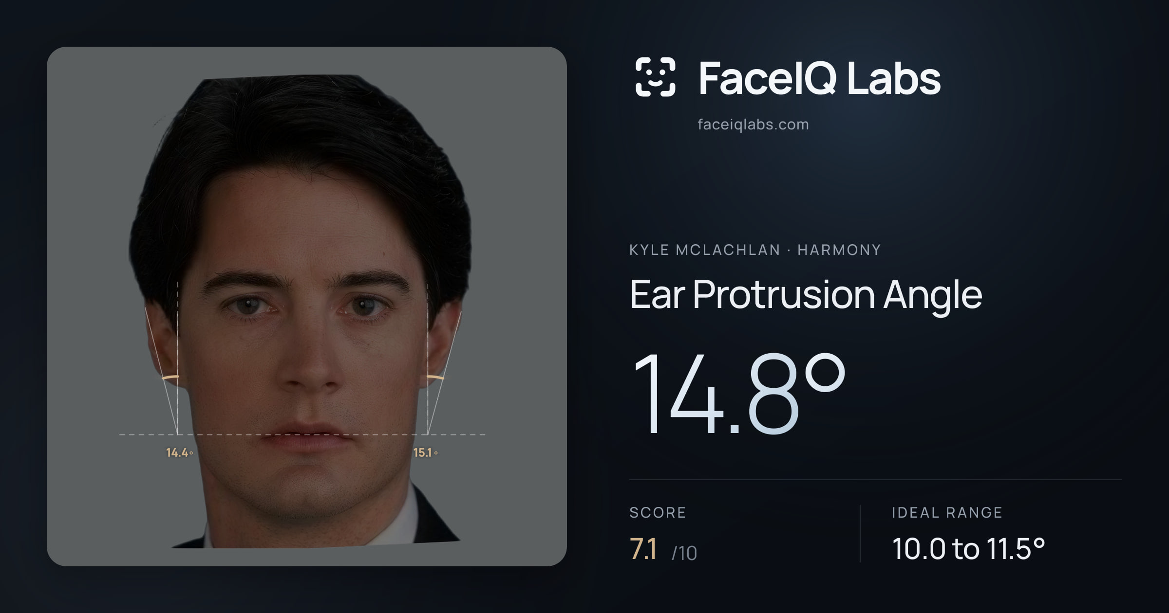 Kyle McLachlan Ear Protrusion Angle: 14.8°, drawn on the photo