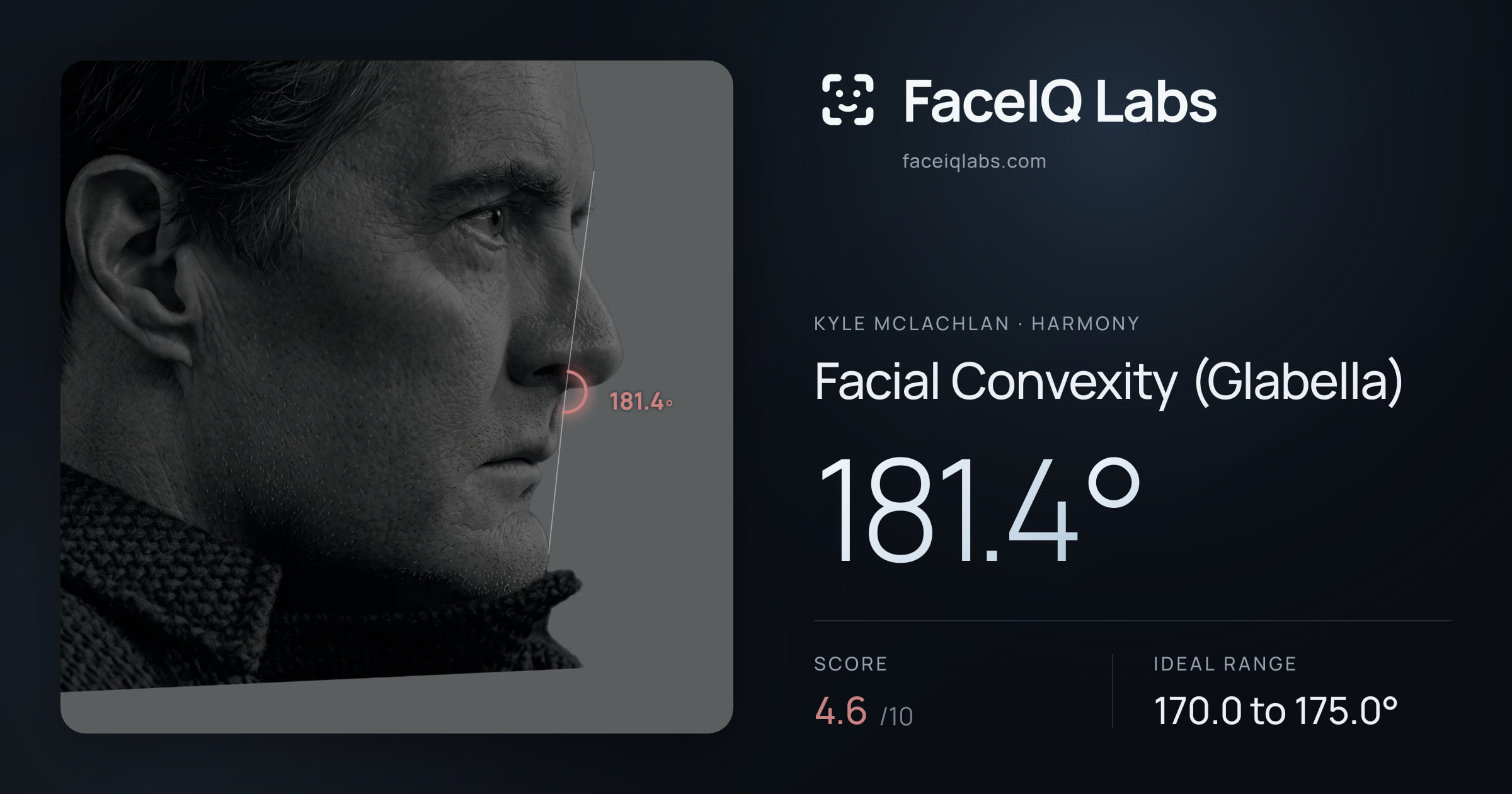 Kyle McLachlan Facial Convexity (Glabella): 181.4°, drawn on the photo
