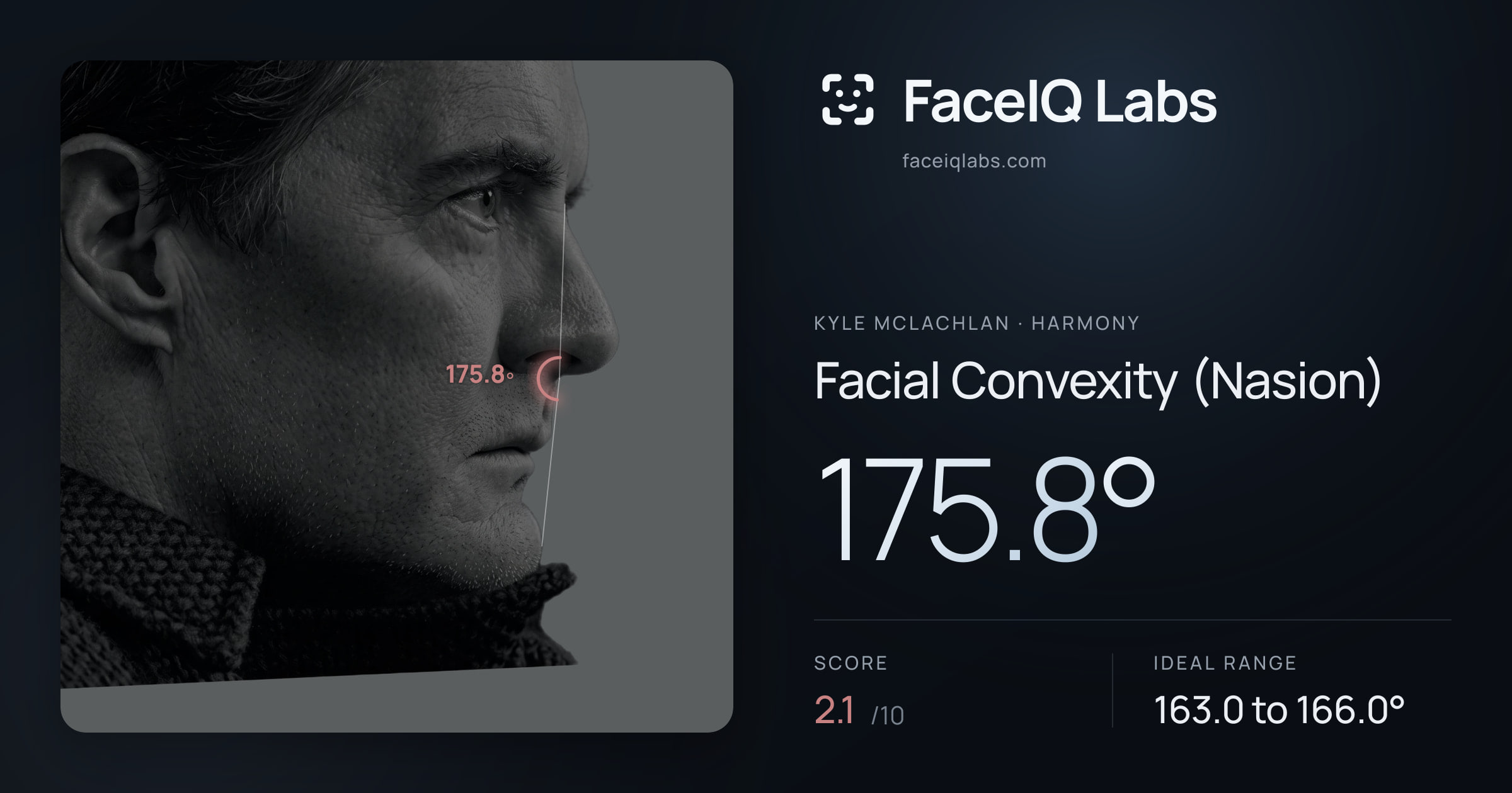 Kyle McLachlan Facial Convexity (Nasion): 175.8°, drawn on the photo