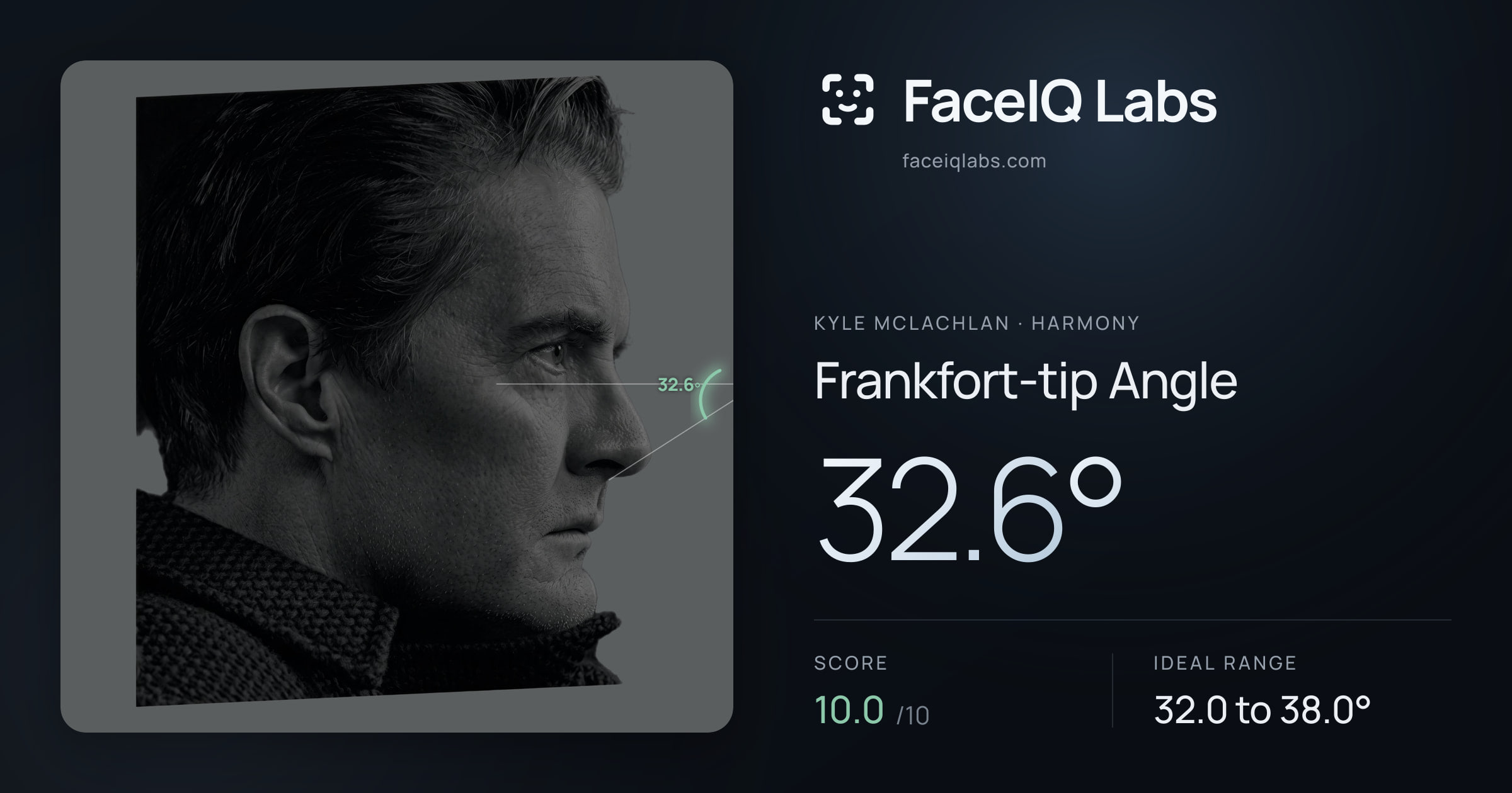 Kyle McLachlan Frankfort-tip Angle: 32.6°, drawn on the photo