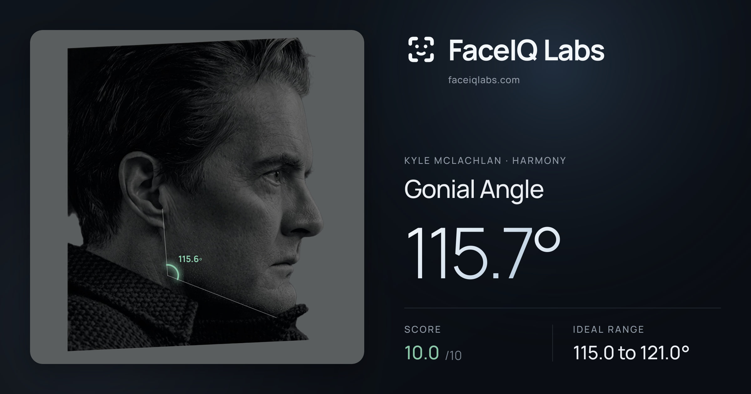 Kyle McLachlan Gonial Angle: 115.7°, drawn on the photo